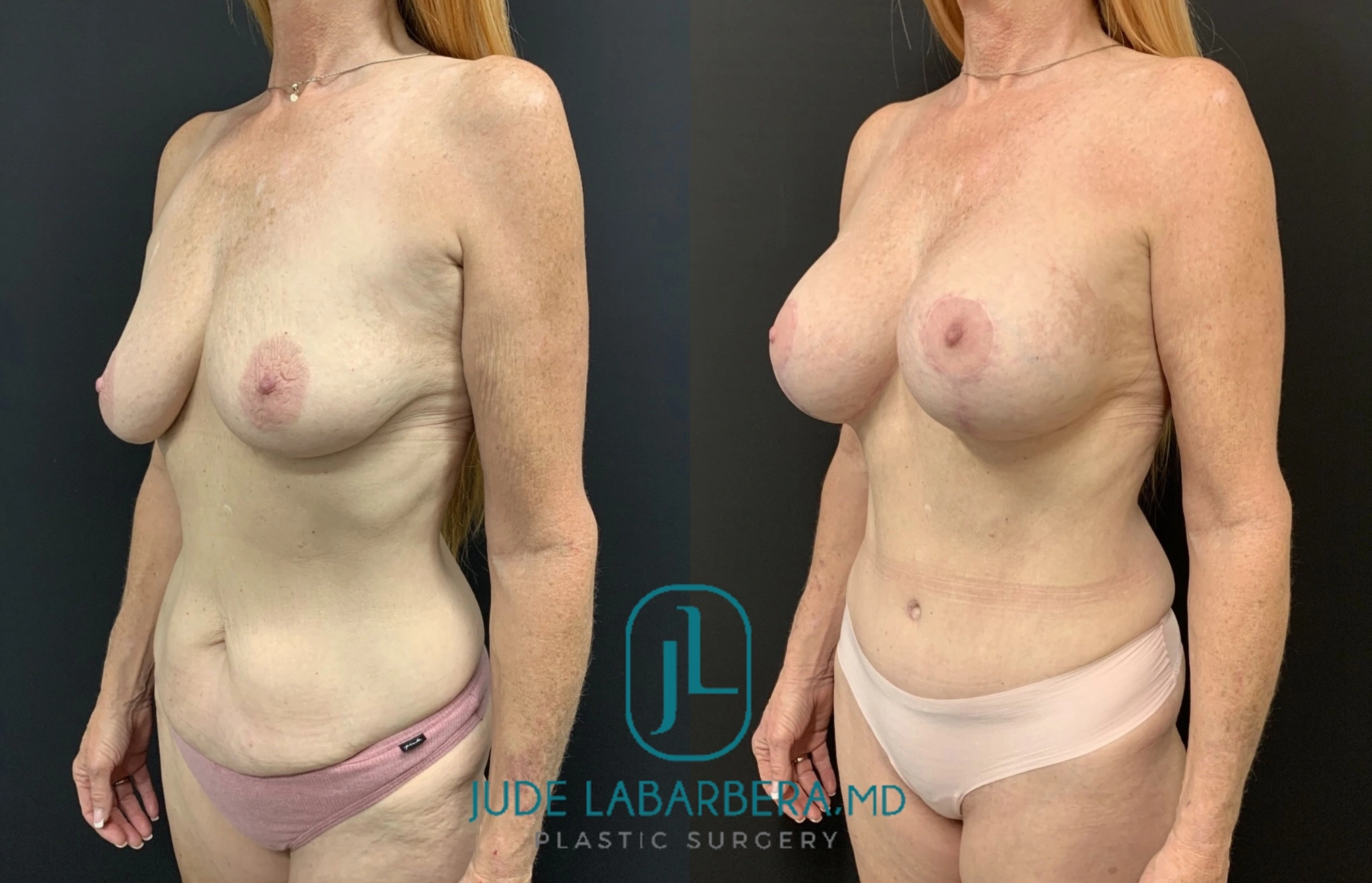 eZy Watermark_11-11-2024_09-40-35-1170AM