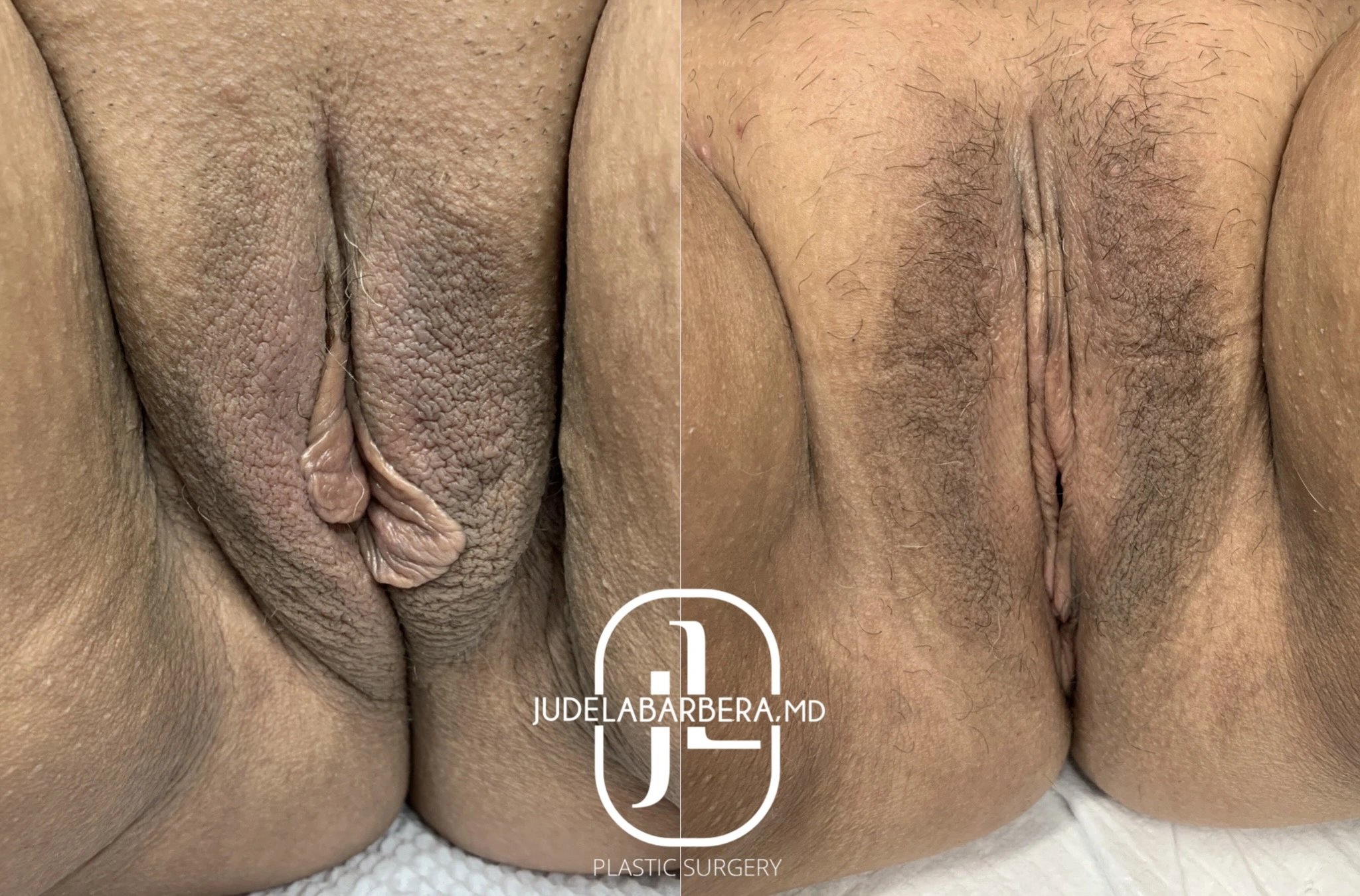 eZy Watermark_10-03-2025_09-17-38-3620AM