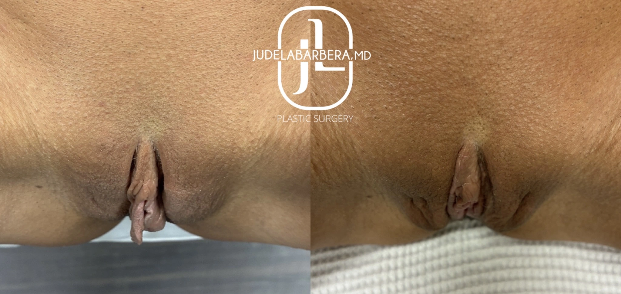 eZy Watermark_25-04-2025_03-43-26-2420PM