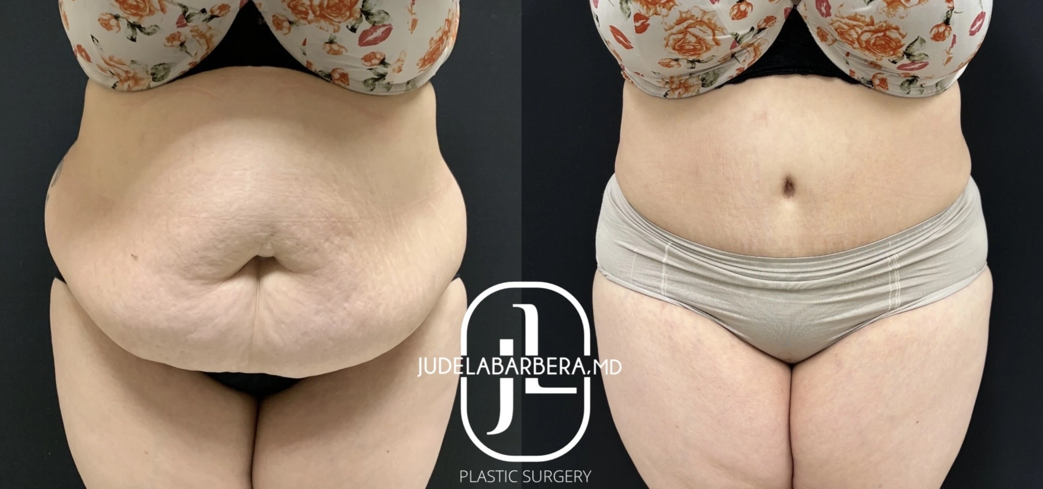 Case Number 000153-TT