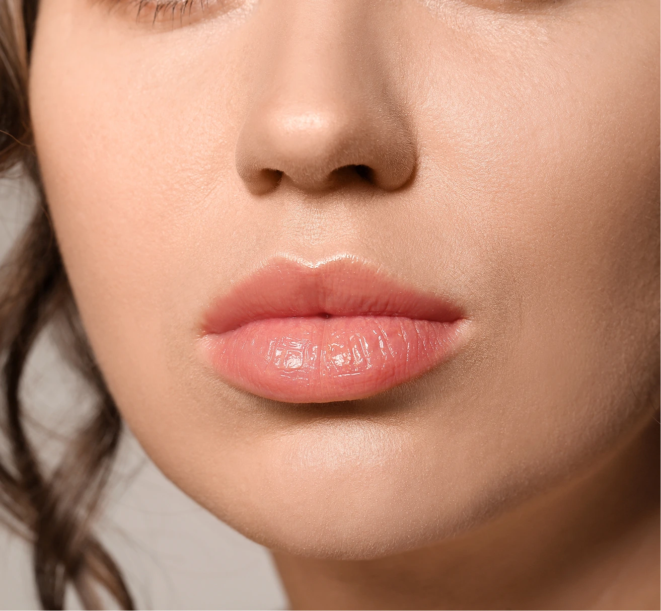 Lip Augmentation