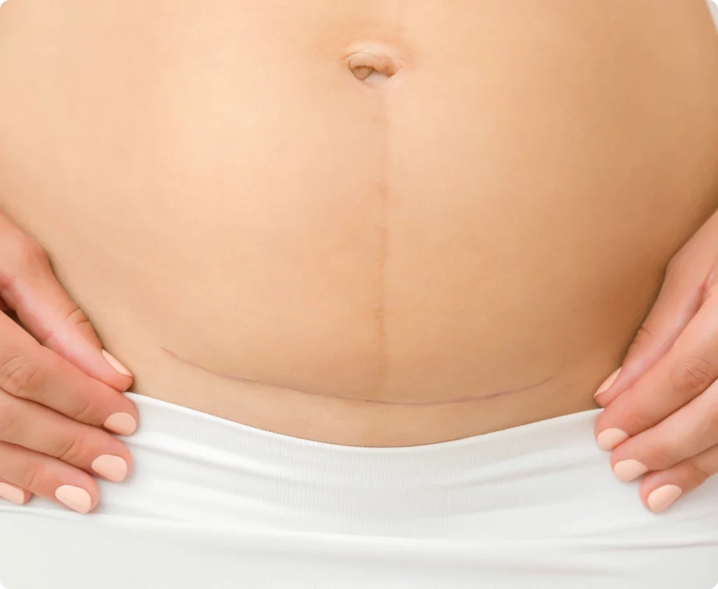 What Are Scars? Banner