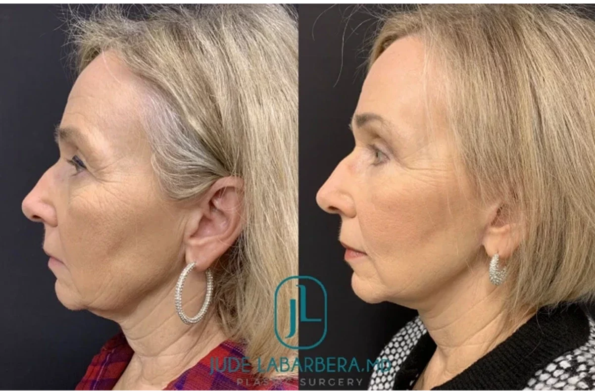 Before & After Photos Banner