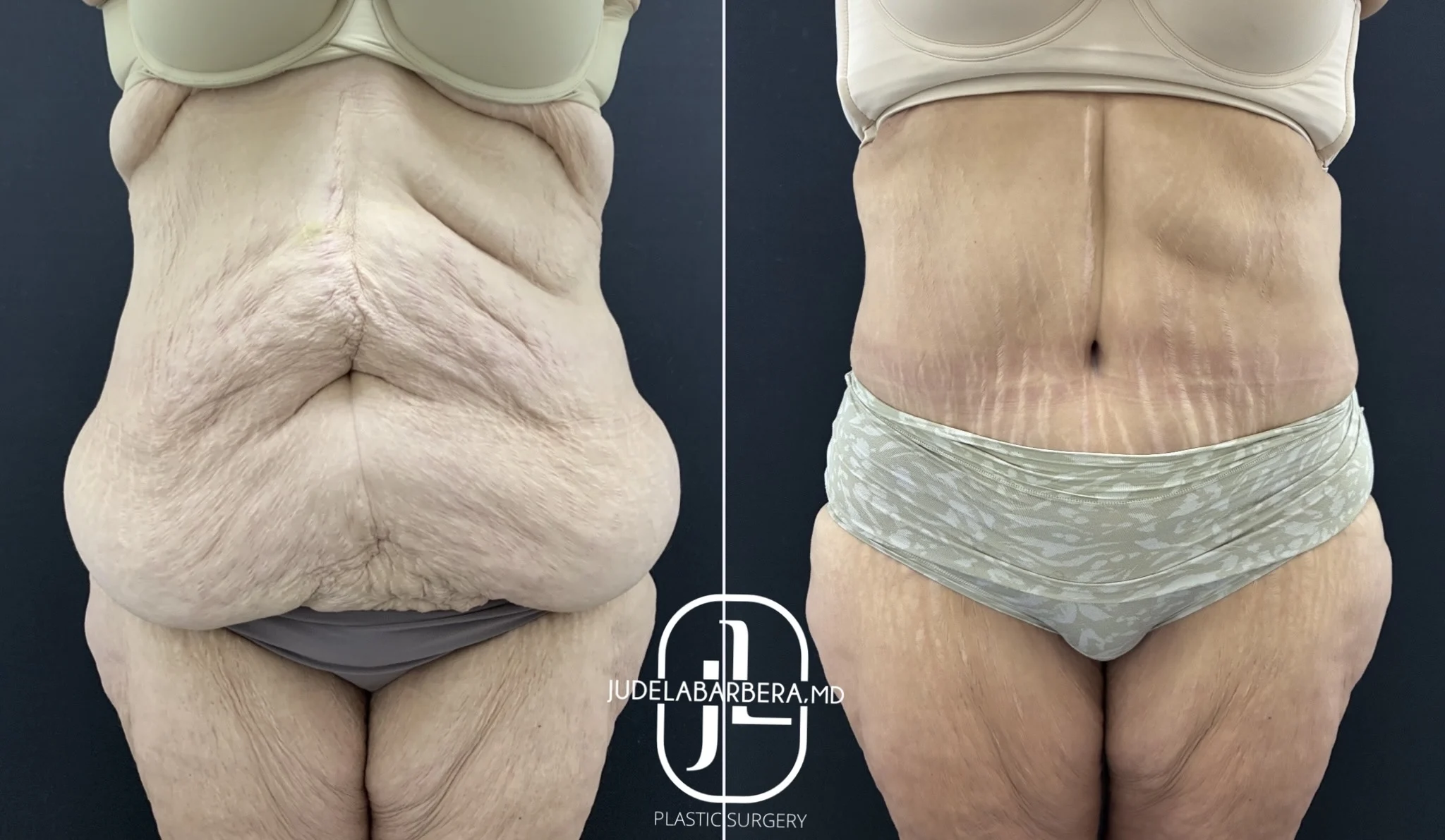 Case Number 000156-TT-front