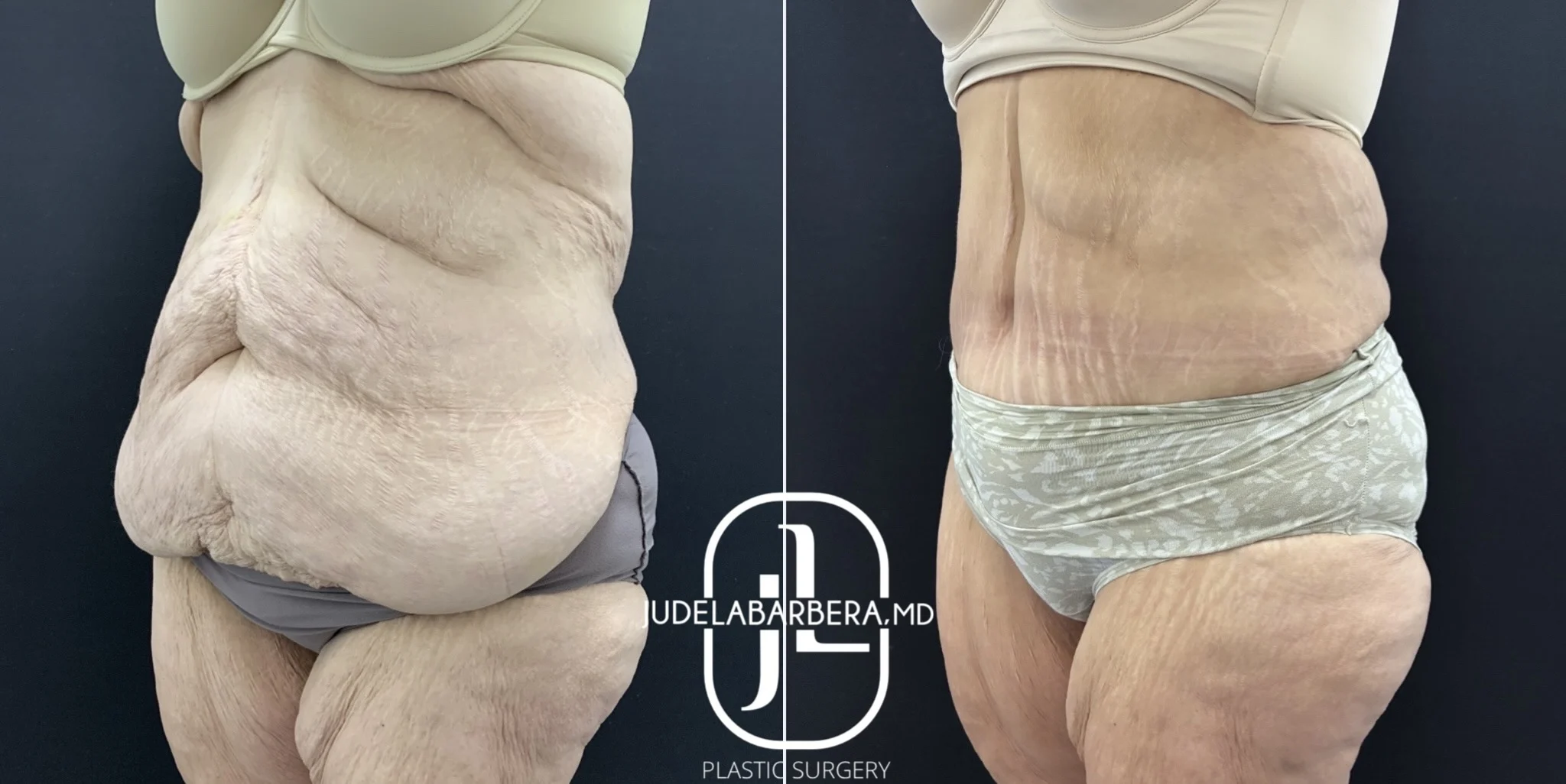 Case Number 000156-TT-side (2)