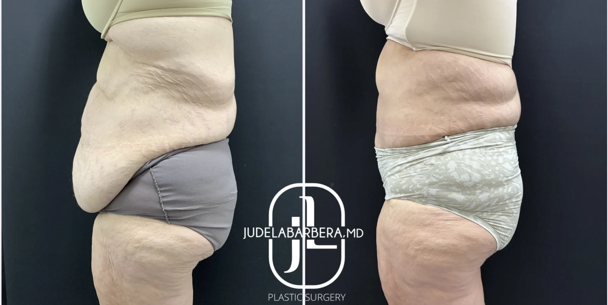 Case Number 000156-TT-side