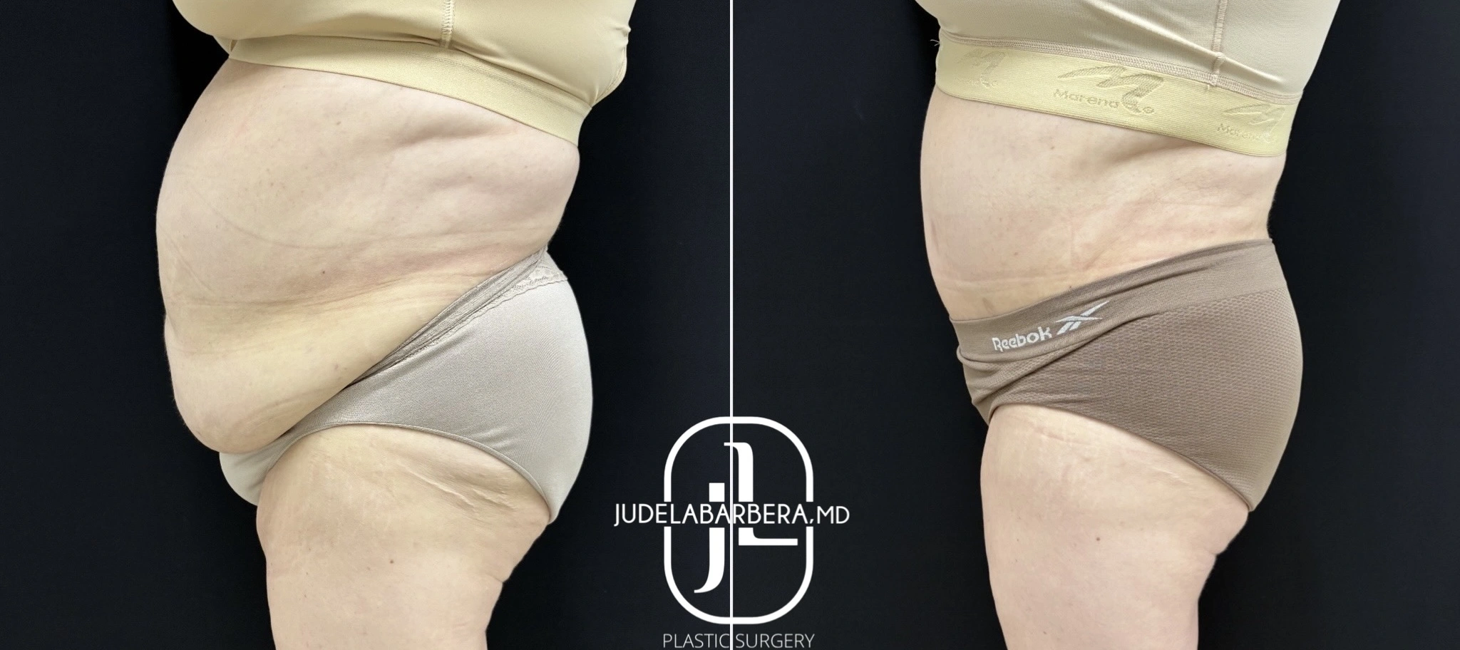 eZy Watermark_22-07-2025_02-17-11-6610PM