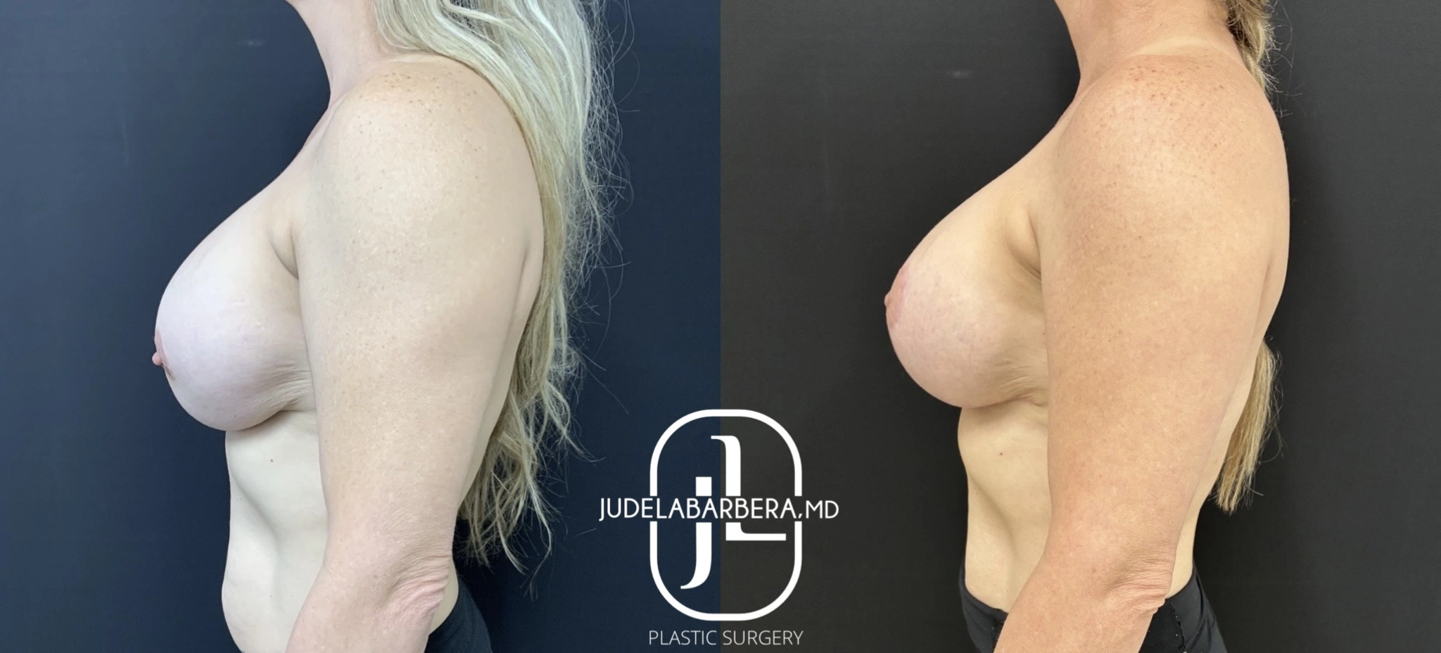 eZy Watermark_10-09-2025_10-33-12-3370AM