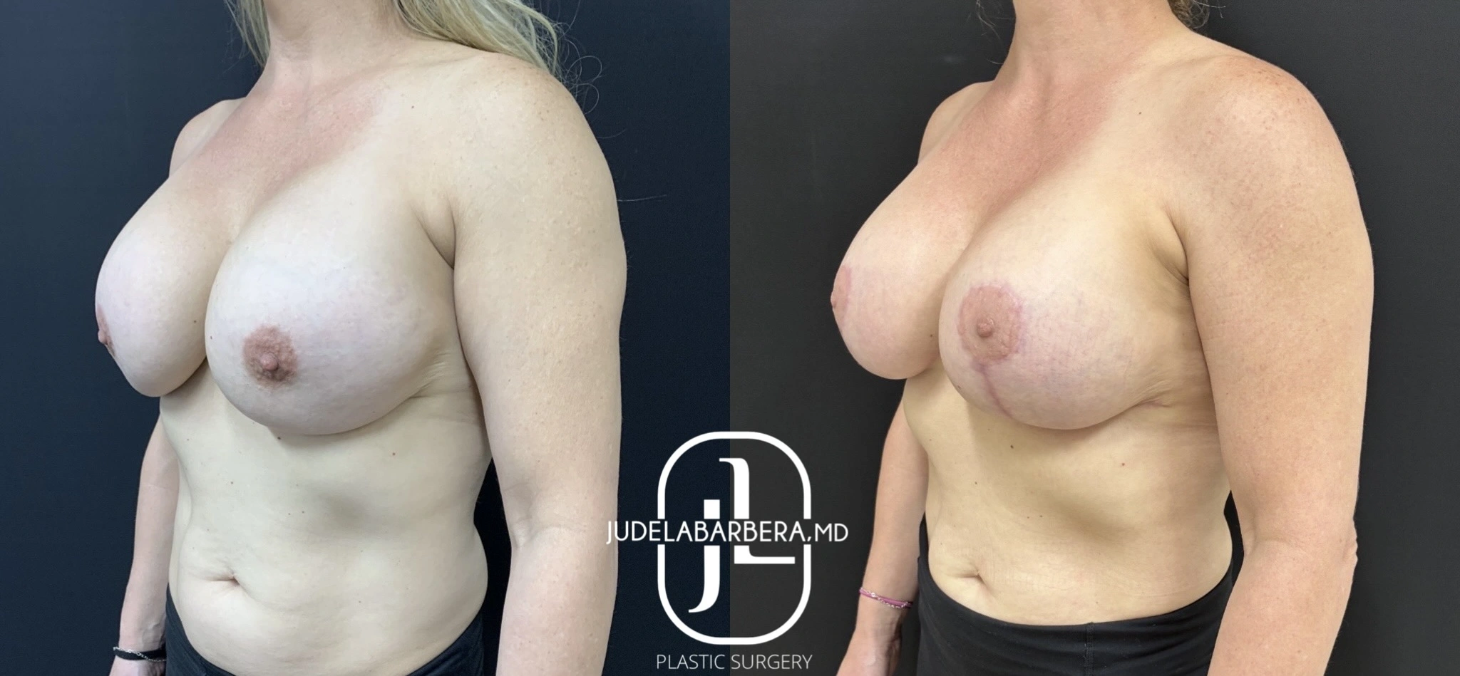 eZy Watermark_10-09-2025_10-33-26-9410AM