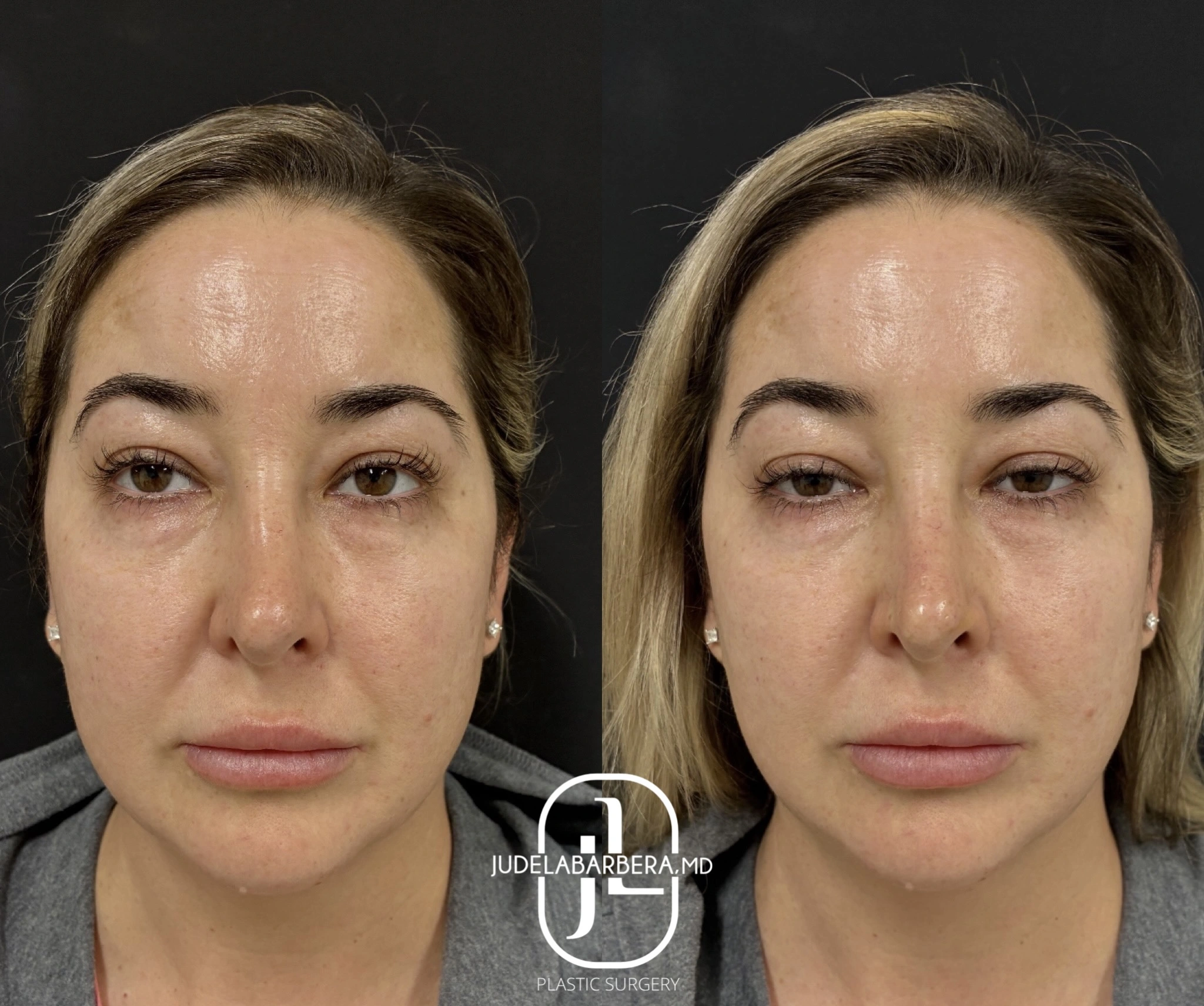 eZy Watermark_20-11-2025_12-44-13-5270PM