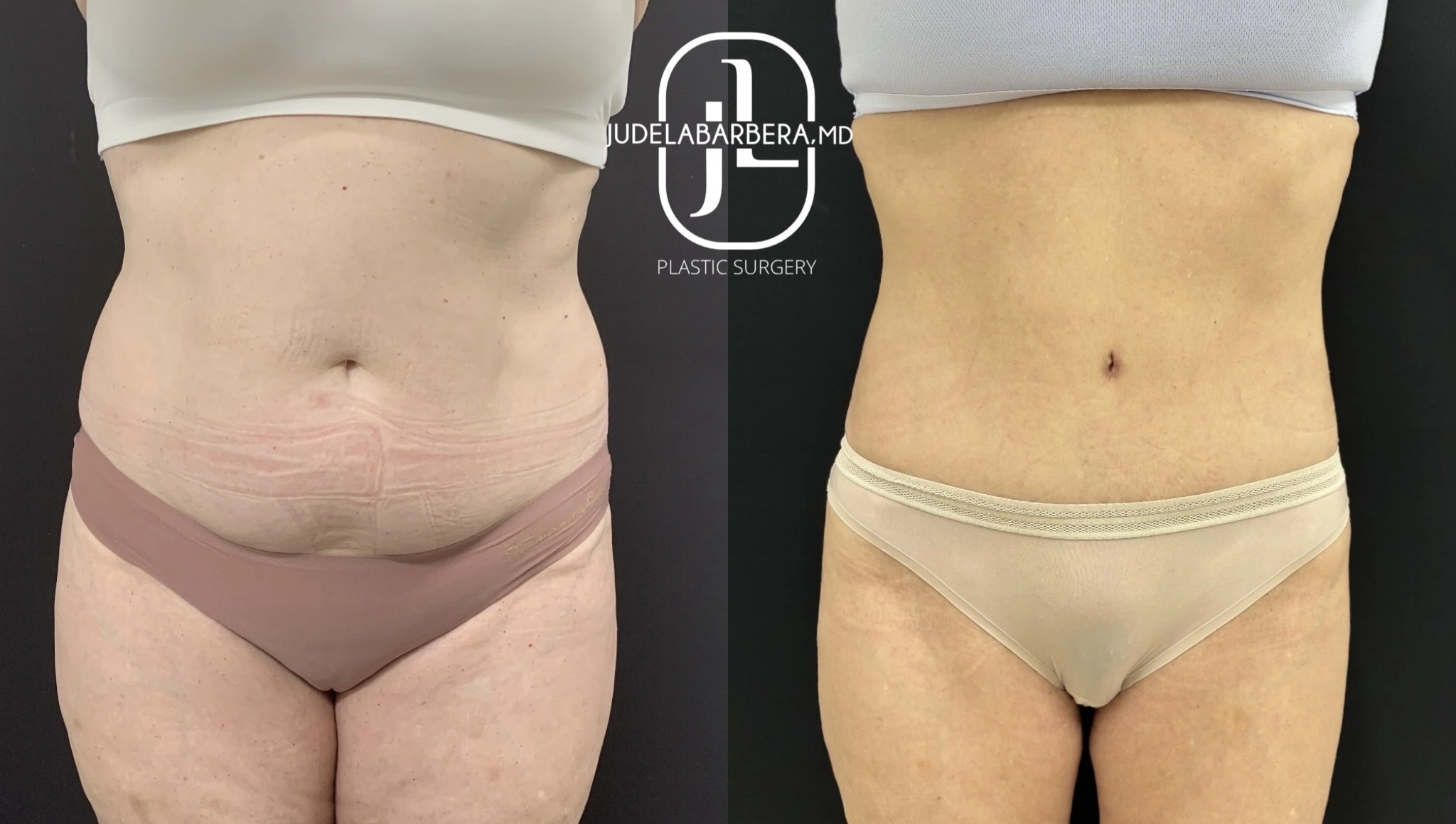 eZy Watermark_03-12-2025_01-47-07-6620PM