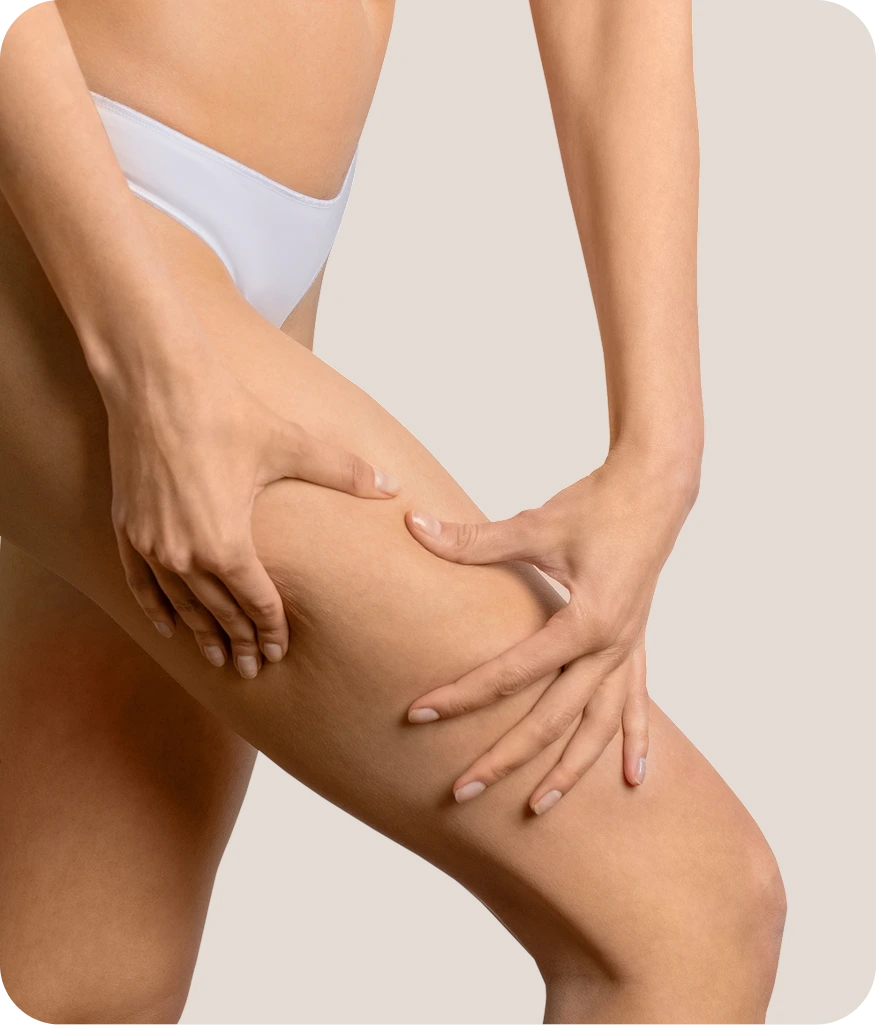 Woman examining her thigh while wearing white briefs, illustrating skin laxity that thigh lift surgery addresses