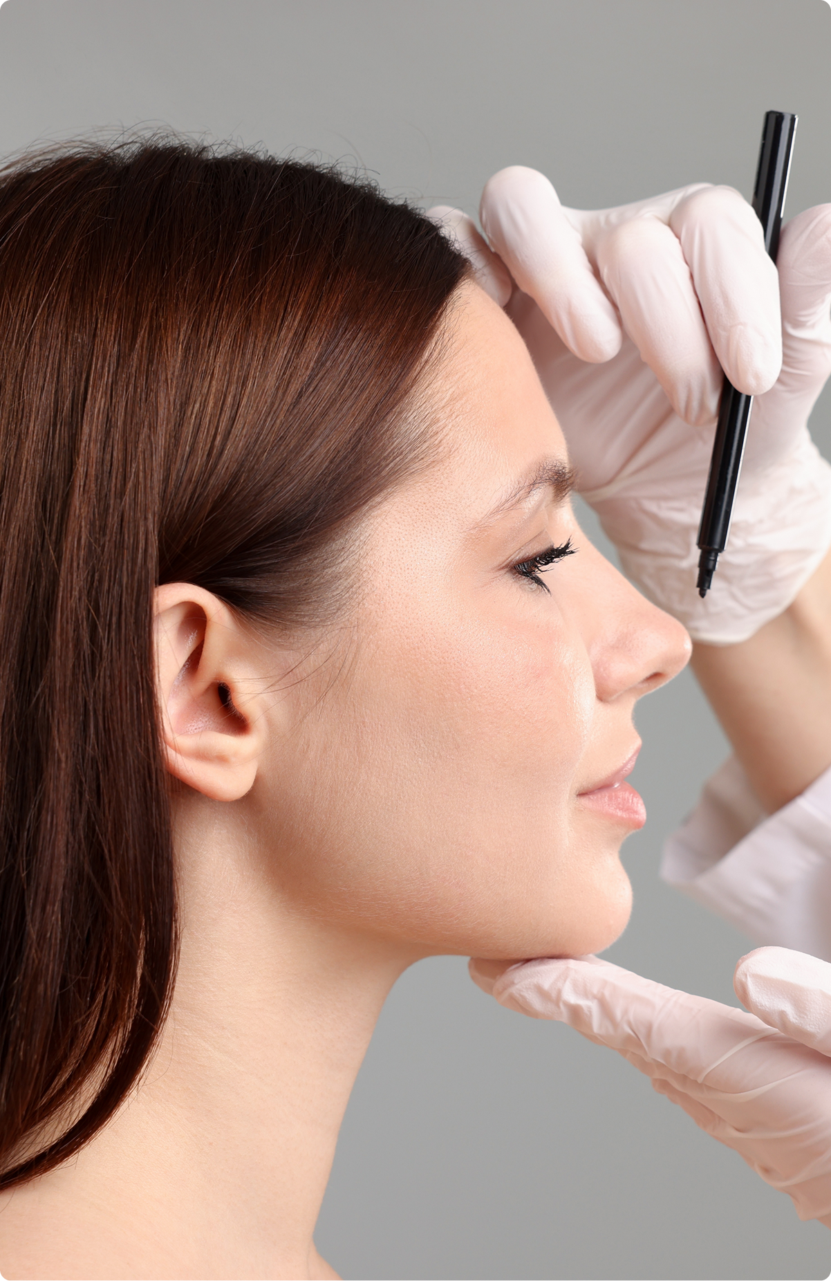 Surgeon in gloves marking rhinoplasty procedure guidelines on patient's nose profile