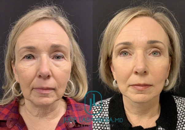 Screenshot 2024-12-02 135541