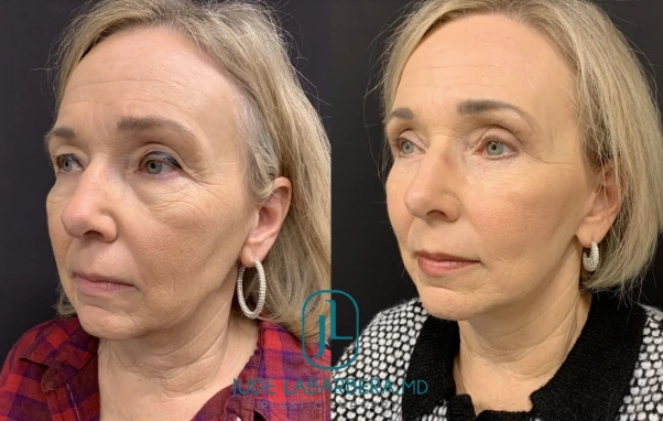 Screenshot 2024-12-02 135604