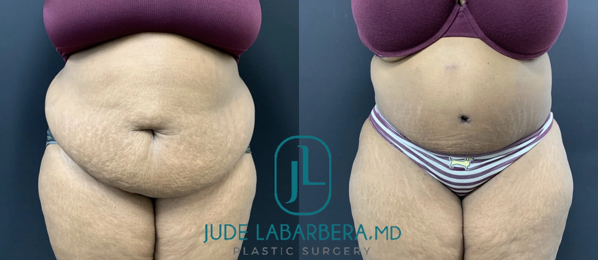 Before & after Banner