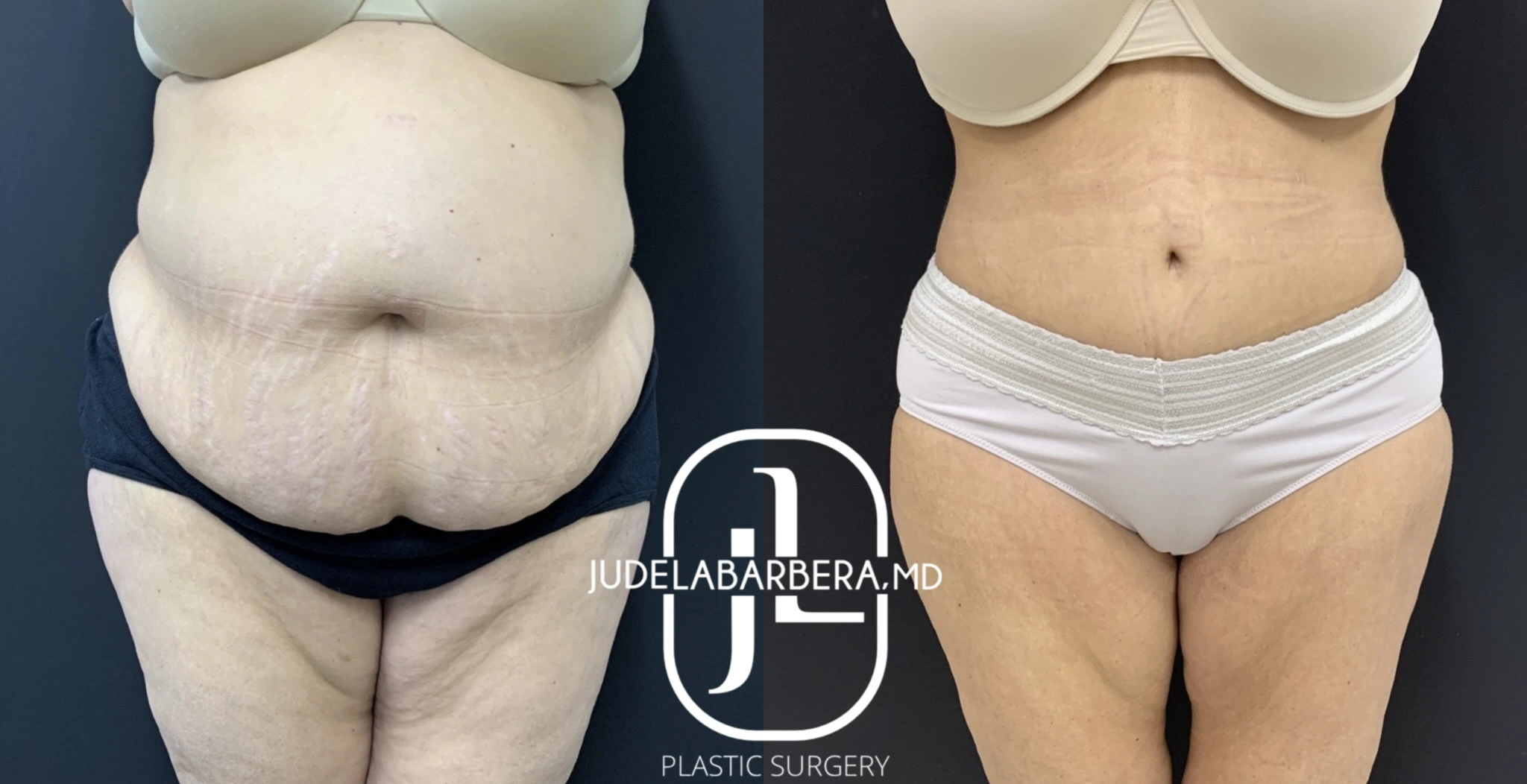 eZy Watermark_03-03-2025_10-14-46-2360PM