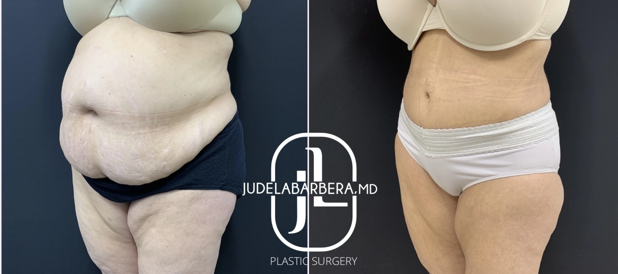 eZy Watermark_03-03-2025_10-15-04-8370PM