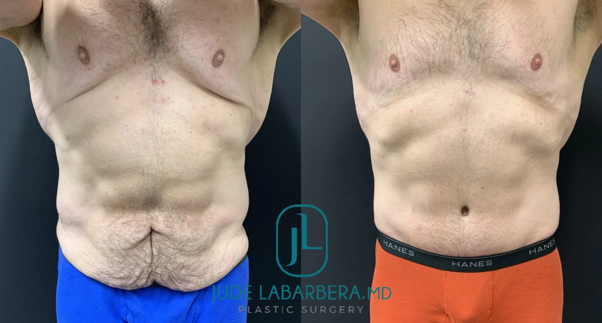 eZy Watermark_04-03-2024_12-05-51-6280PM