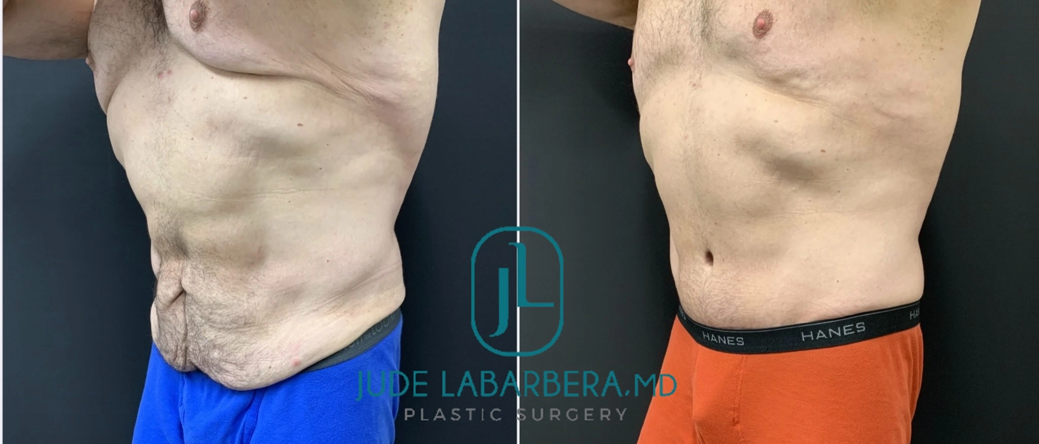 eZy Watermark_04-03-2024_12-06-05-3210PM