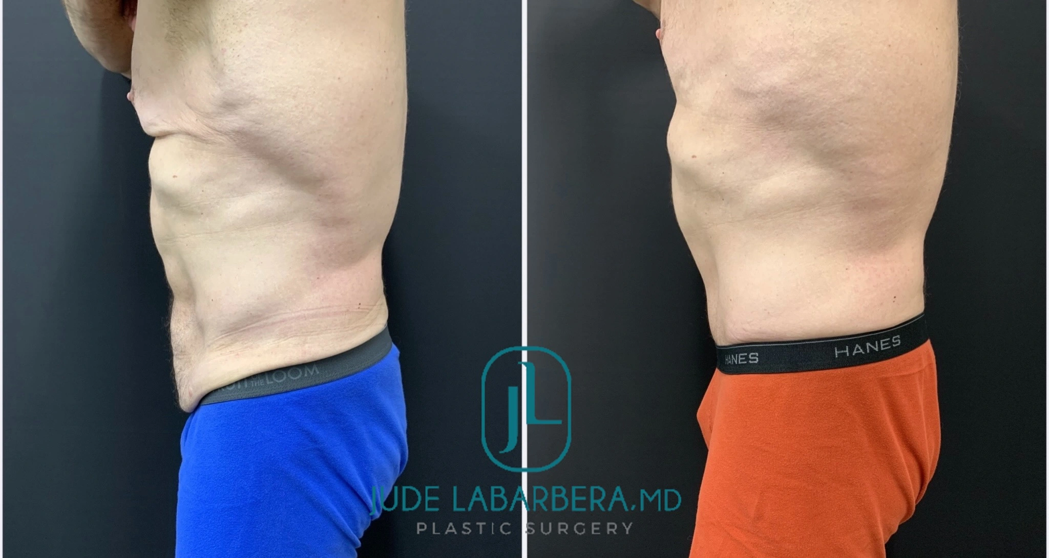 eZy Watermark_04-03-2024_12-06-20-4770PM