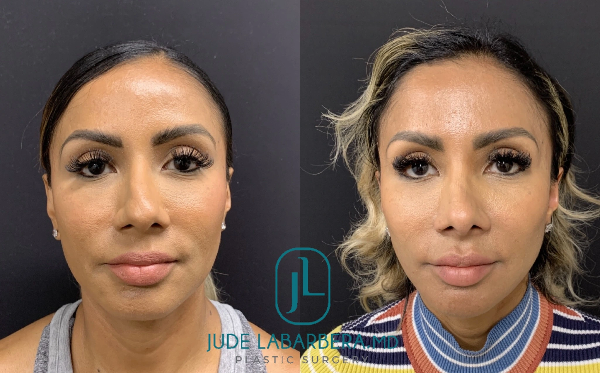 eZy Watermark_09-04-2024_02-45-57-1220PM