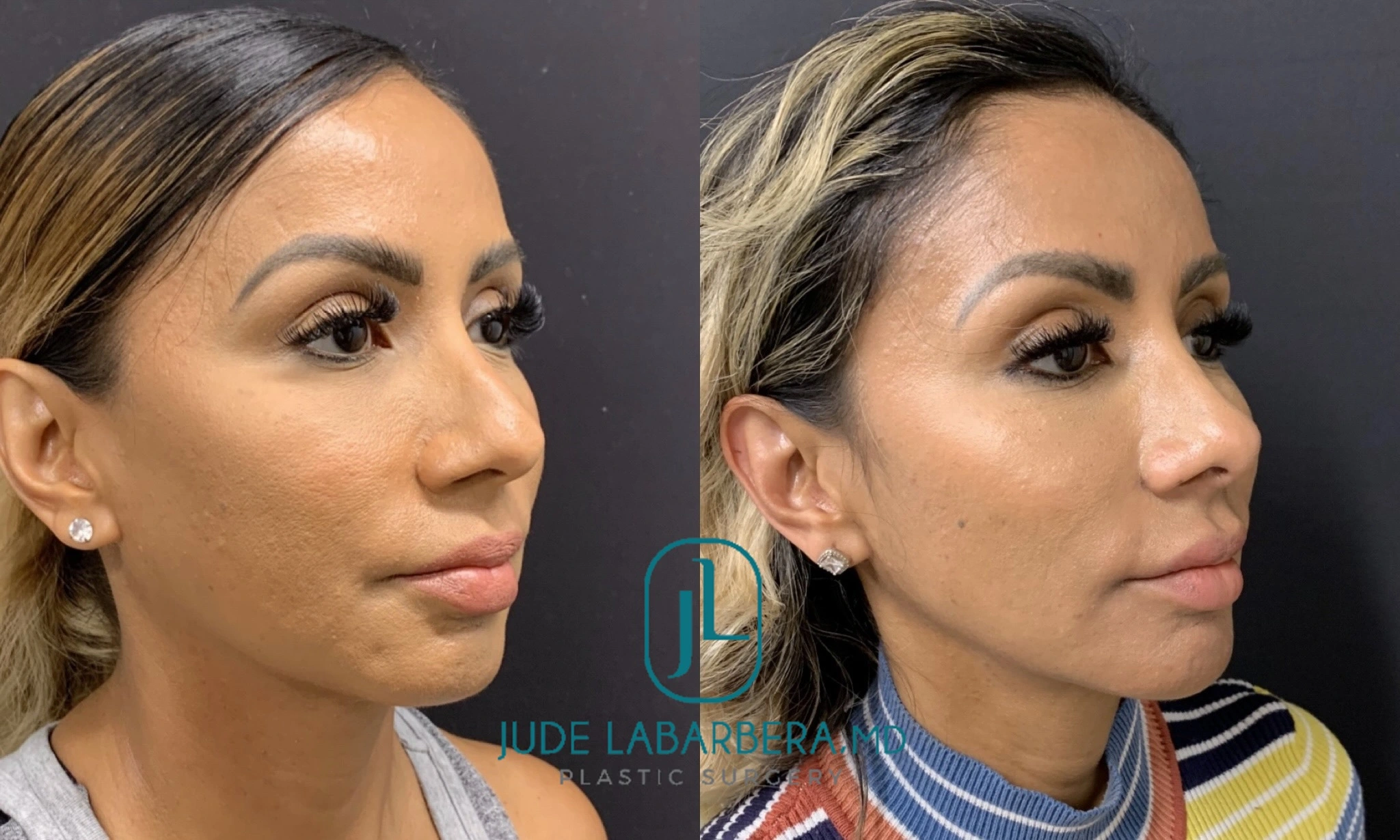 eZy Watermark_09-04-2024_02-46-11-9660PM