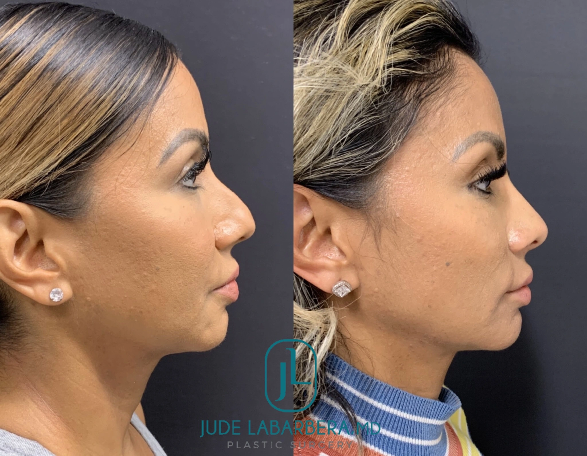 eZy Watermark_09-04-2024_02-46-27-0560PM