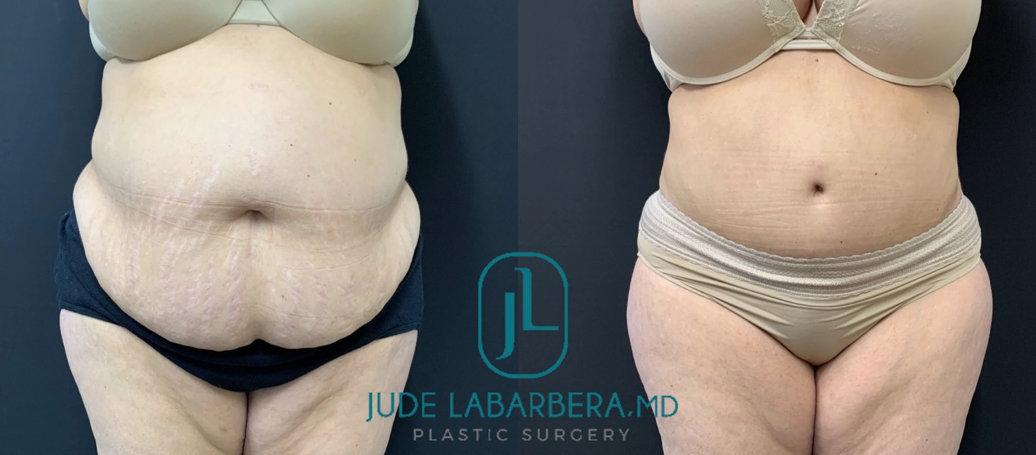 eZy Watermark_10-05-2024_10-33-11-6300AM