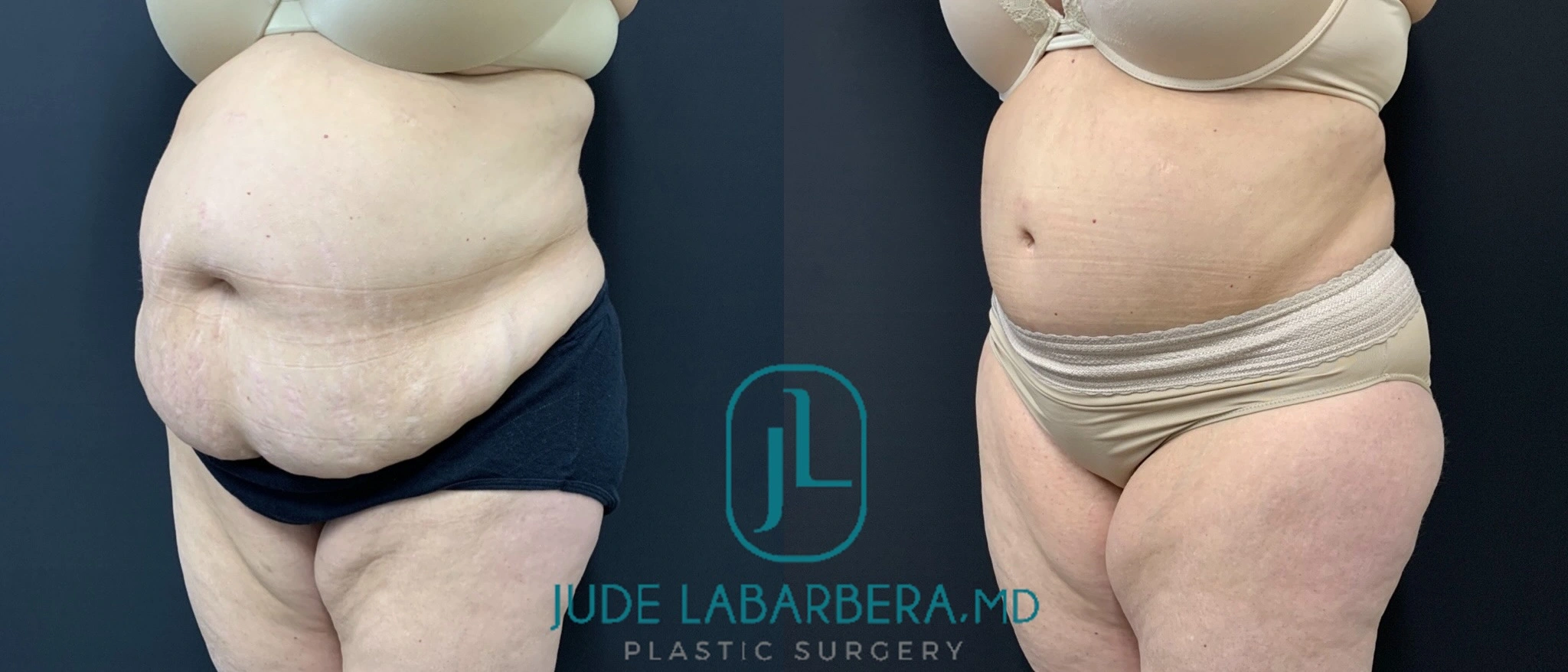 eZy Watermark_10-05-2024_10-33-27-2430AM