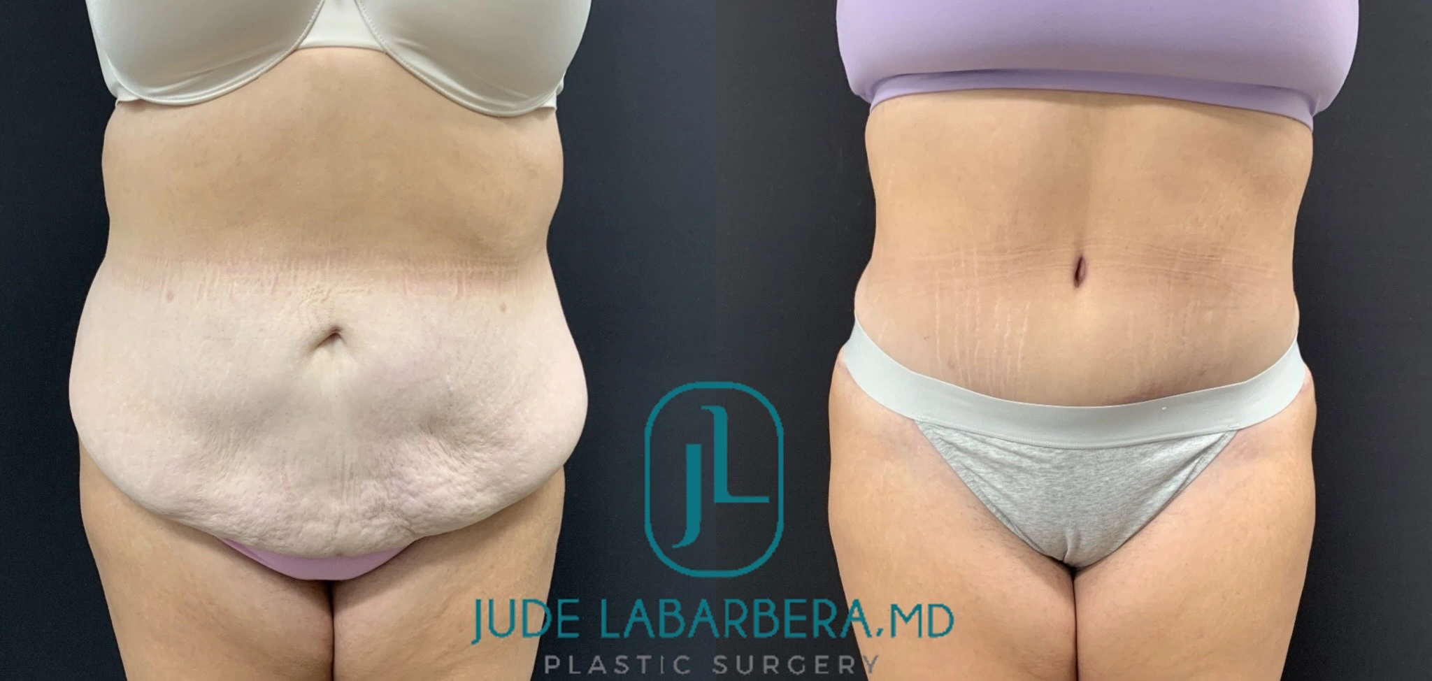 eZy Watermark_11-11-2024_02-44-13-6920PM