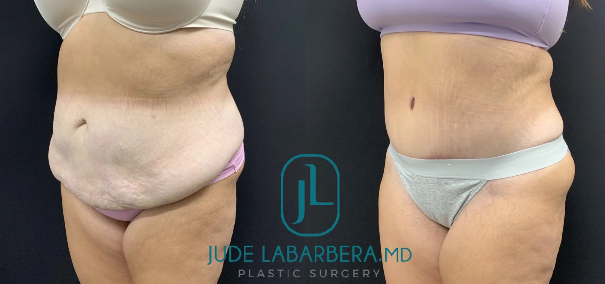 eZy Watermark_11-11-2024_02-44-32-6470PM