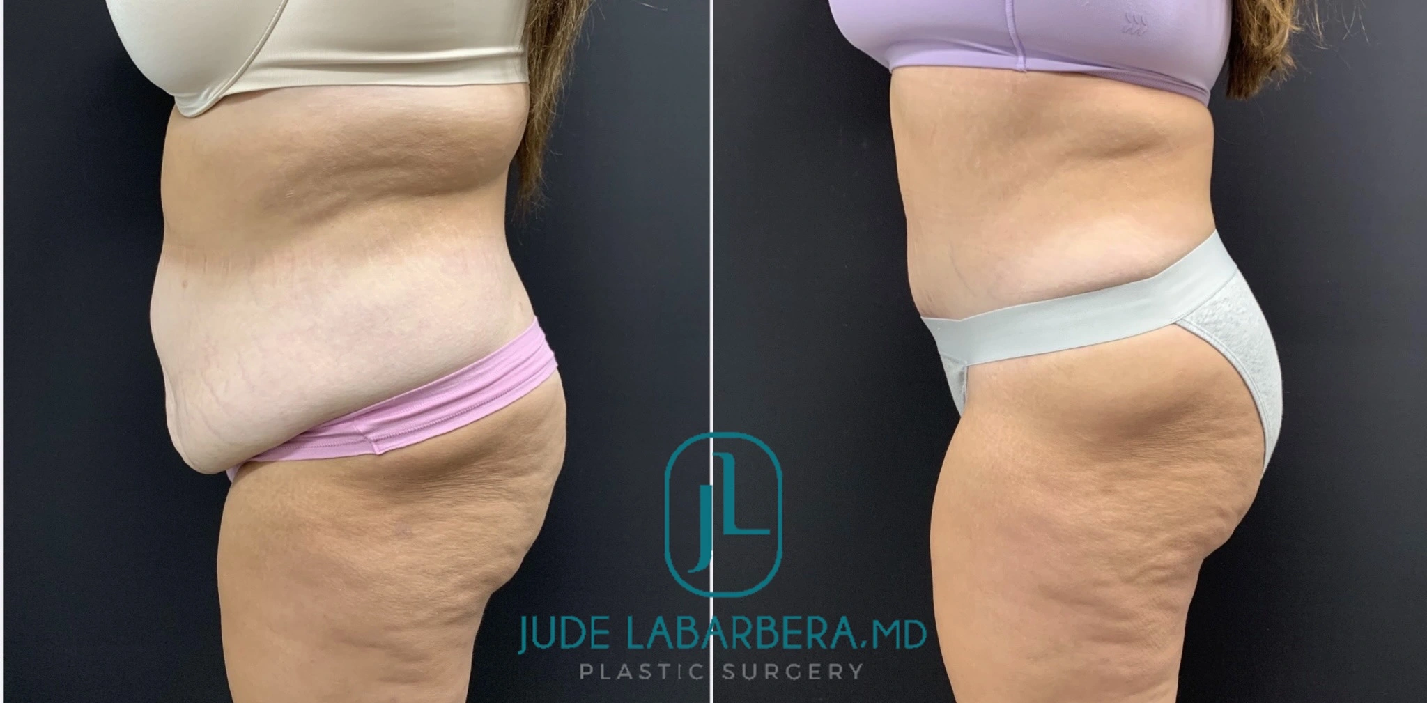 eZy Watermark_11-11-2024_02-44-54-2140PM