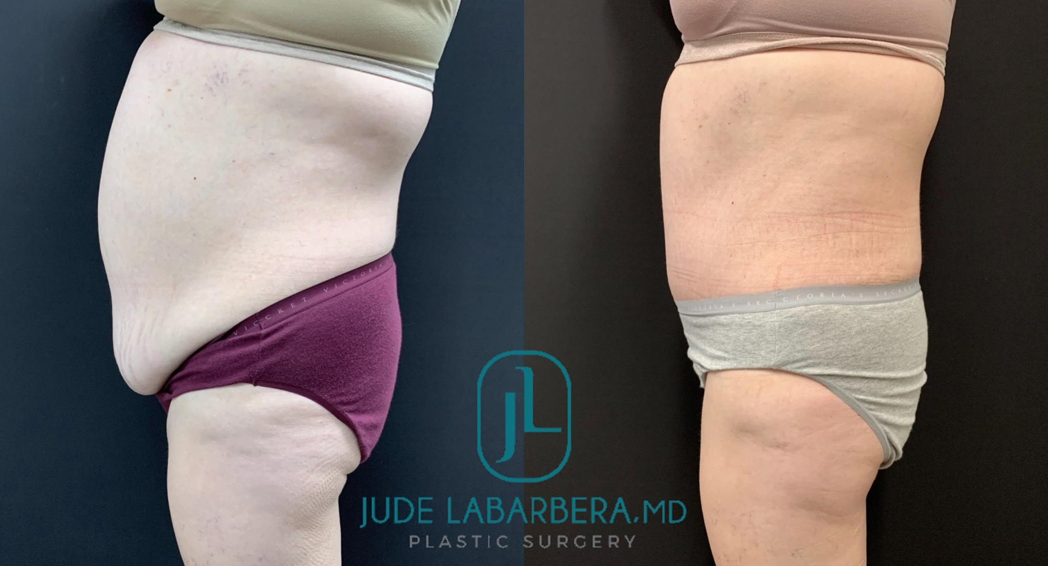 eZy Watermark_15-10-2024_01-10-26-4490PM