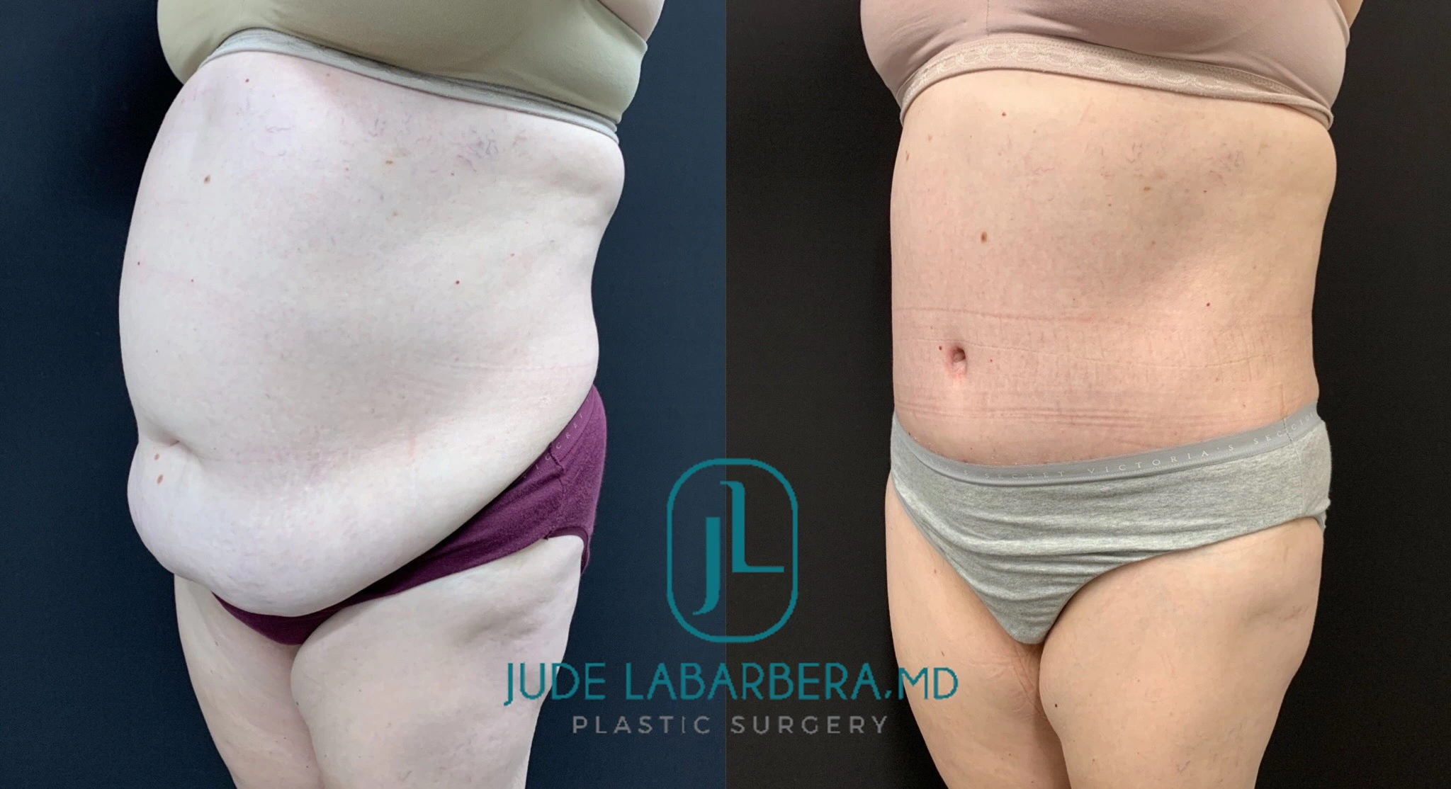 eZy Watermark_15-10-2024_01-10-42-3580PM