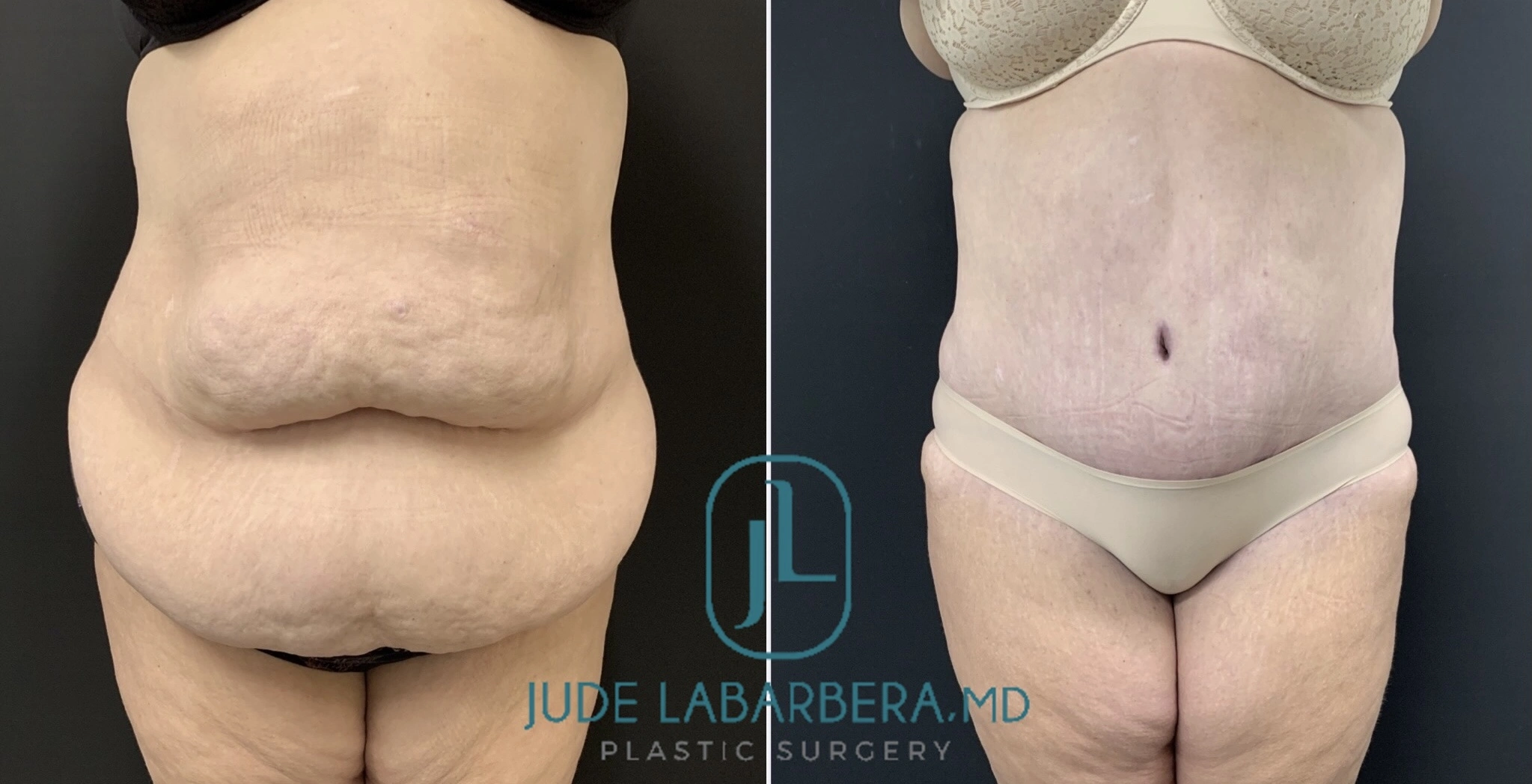 eZy Watermark_16-07-2024_11-42-51-7640AM