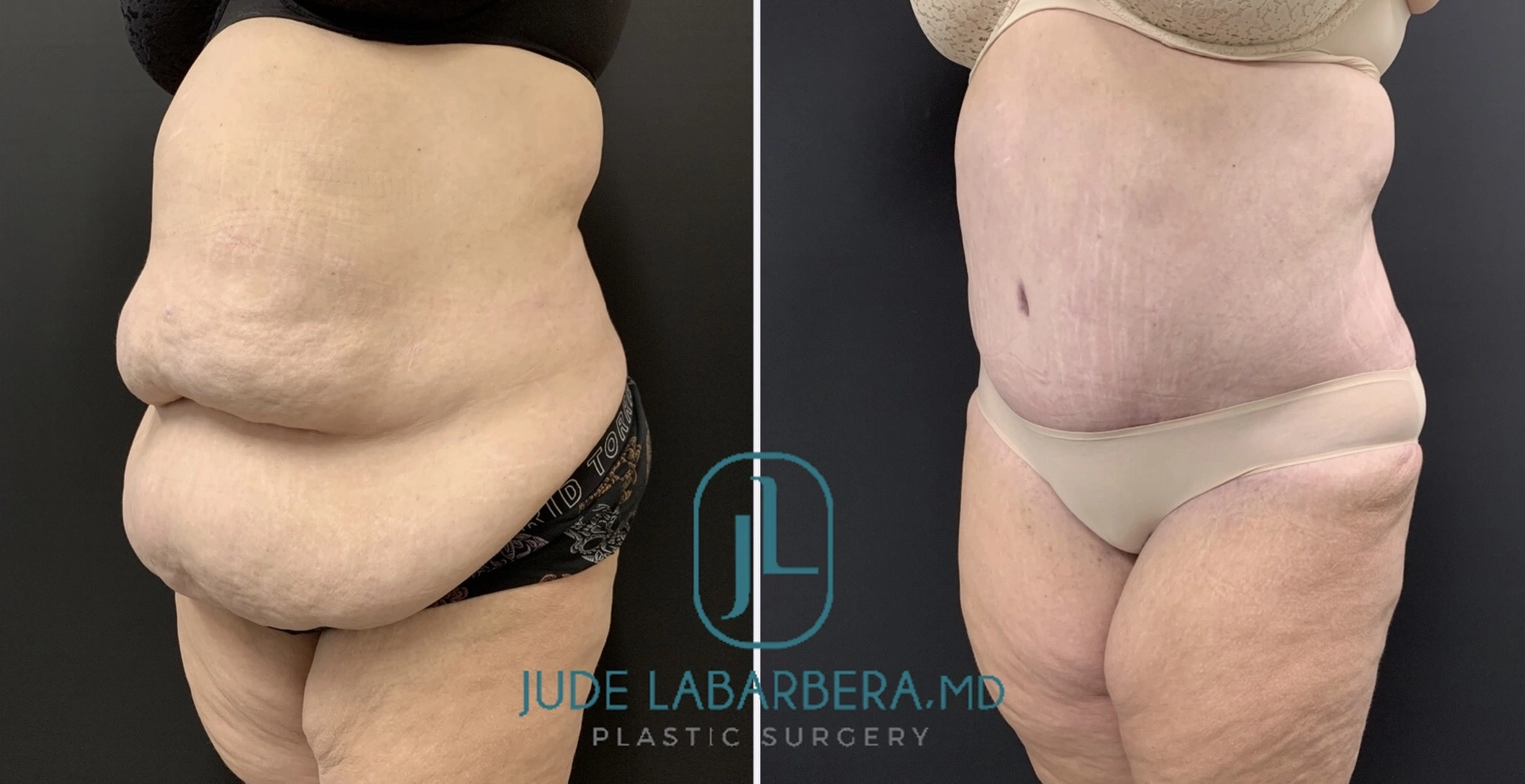 eZy Watermark_16-07-2024_11-43-04-1860AM