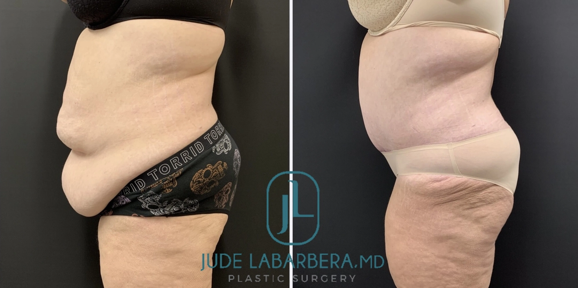 eZy Watermark_16-07-2024_11-43-16-7240AM