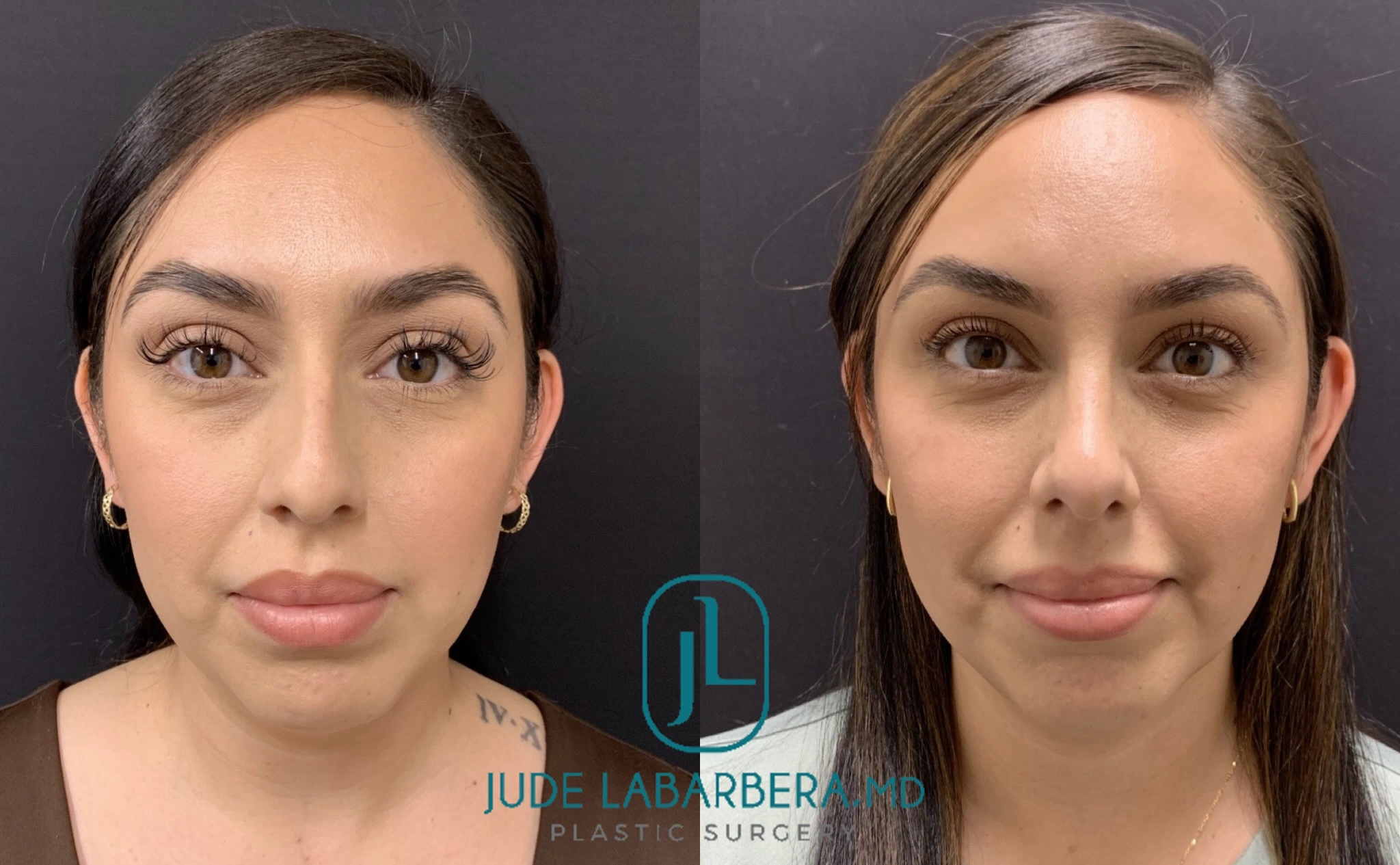 eZy Watermark_17-06-2024_04-12-05-2810PM