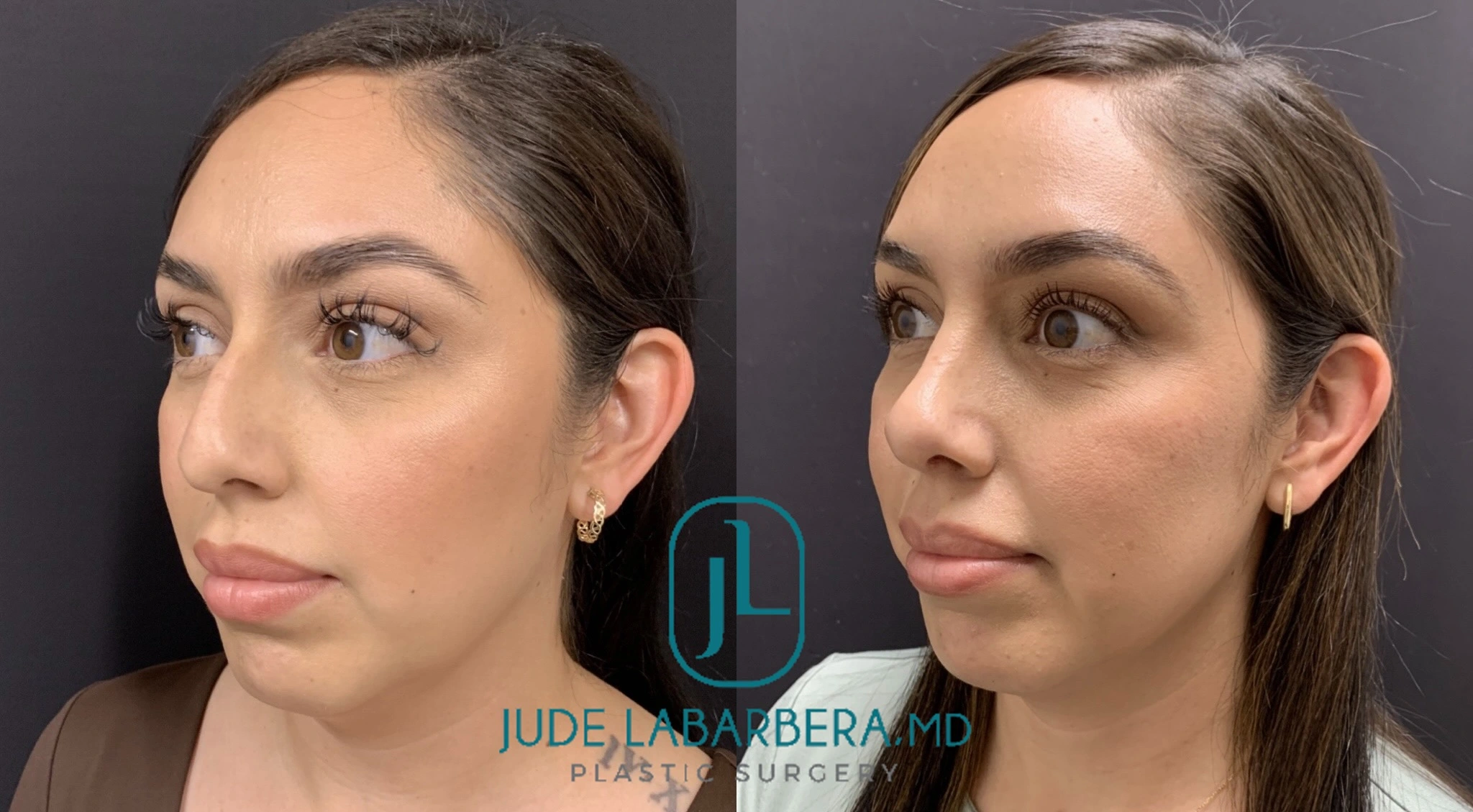 eZy Watermark_17-06-2024_04-12-19-5780PM