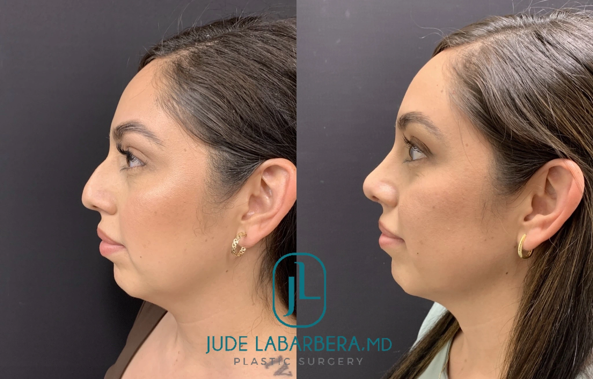 eZy Watermark_17-06-2024_04-12-33-8550PM