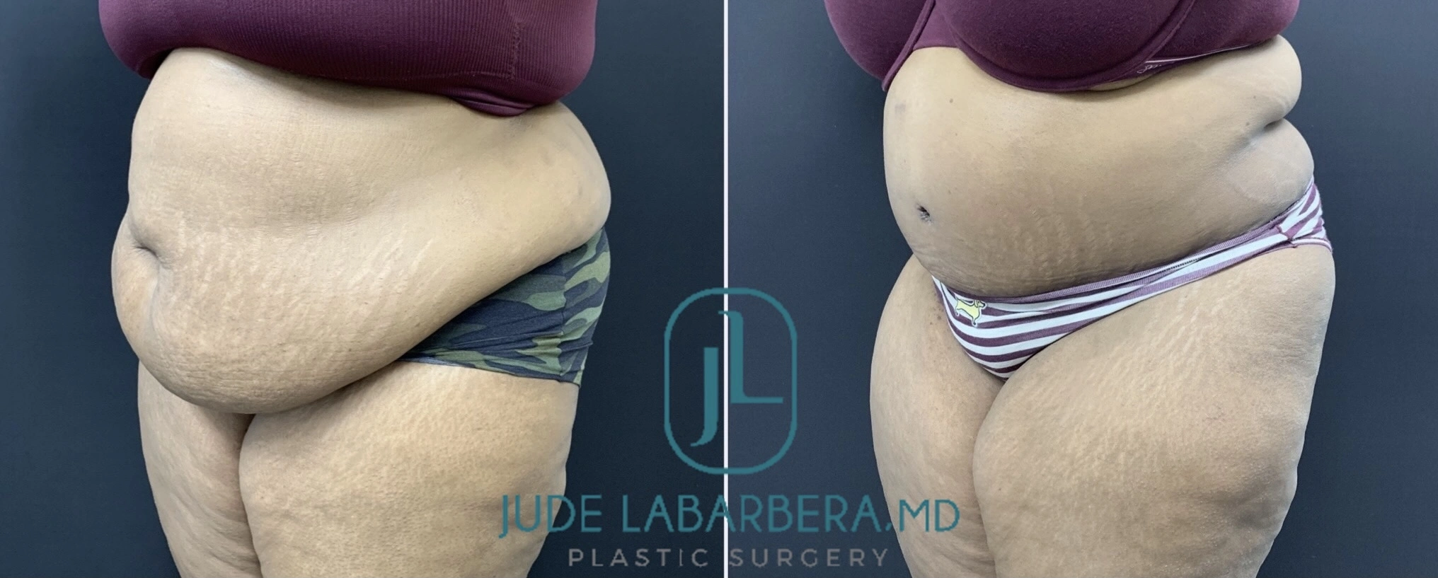 eZy Watermark_19-11-2024_11-32-37-3420AM (1)