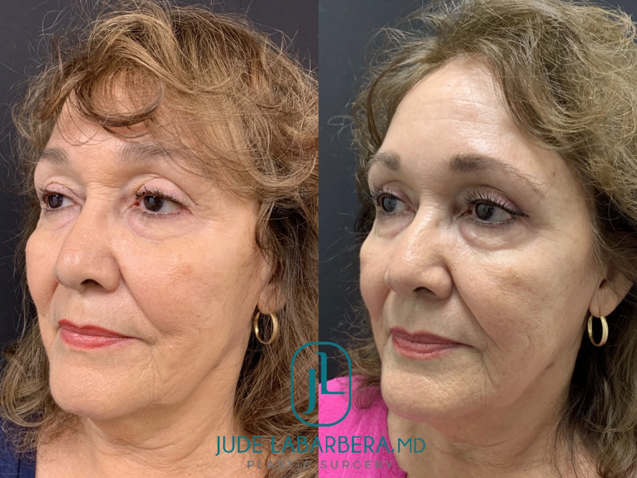 eZy Watermark_25-10-2024_01-07-44-2690PM