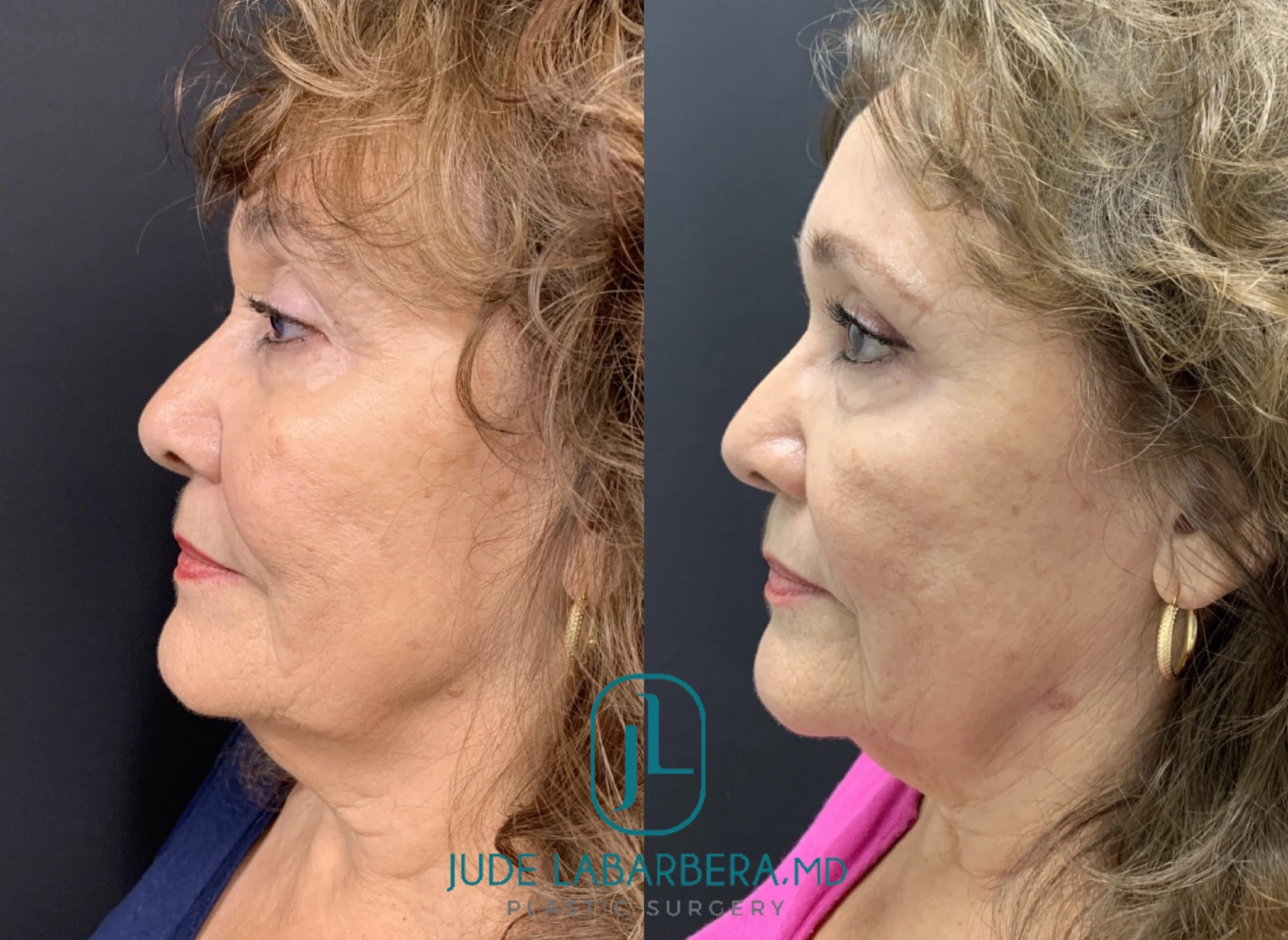 eZy Watermark_25-10-2024_01-07-59-3780PM