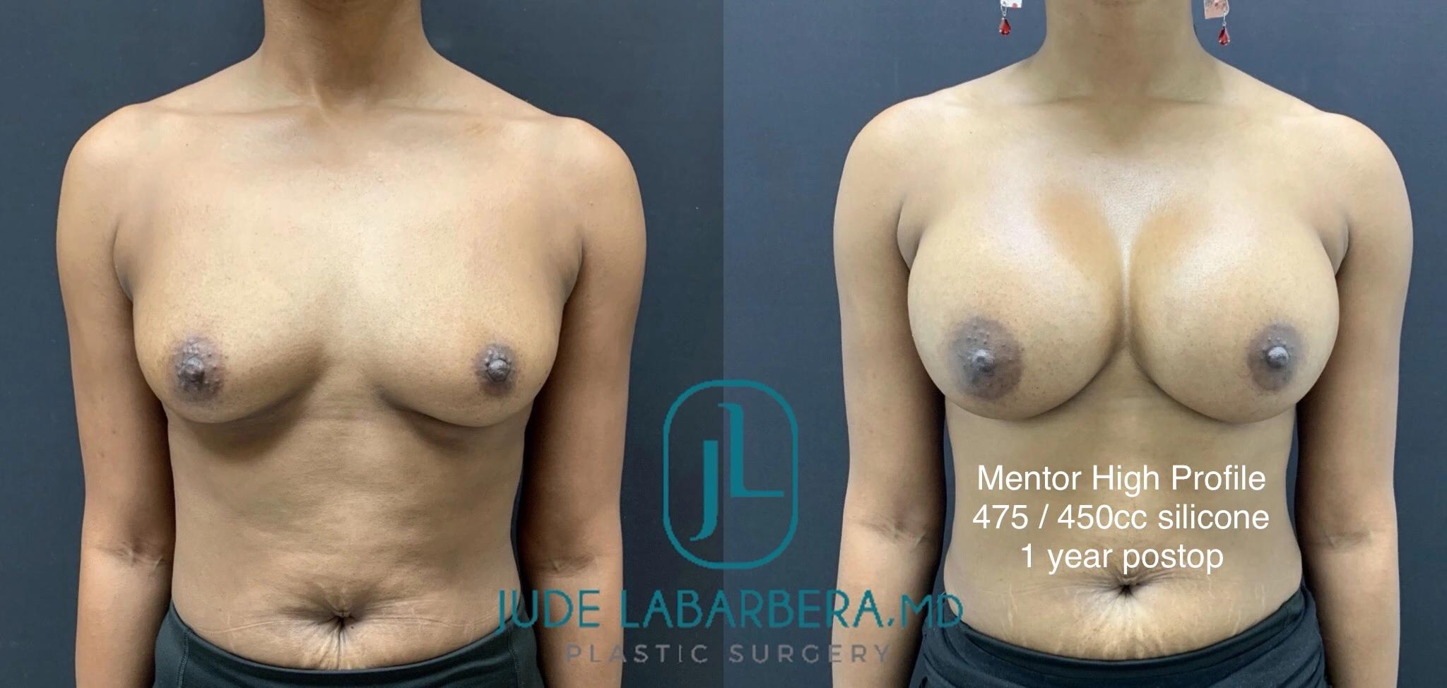 eZy Watermark_25-10-2024_12-58-20-3330PM