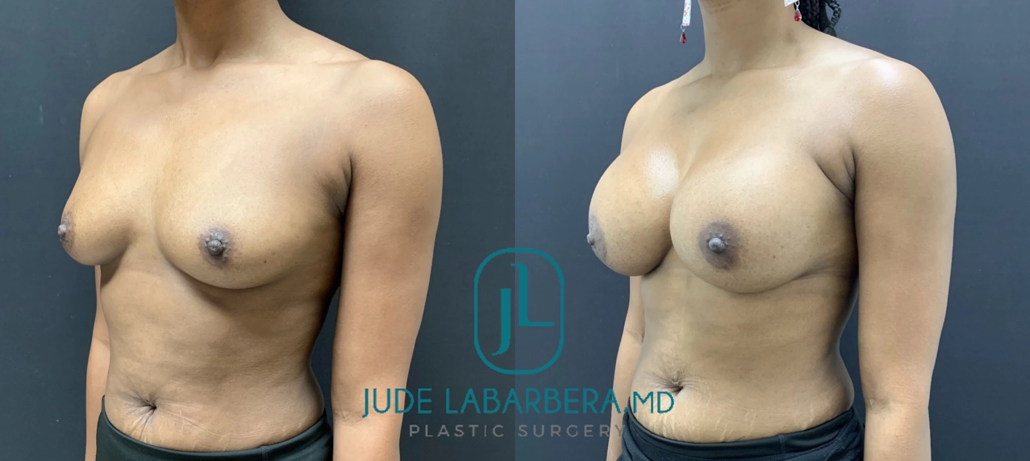 eZy Watermark_25-10-2024_12-58-32-8230PM