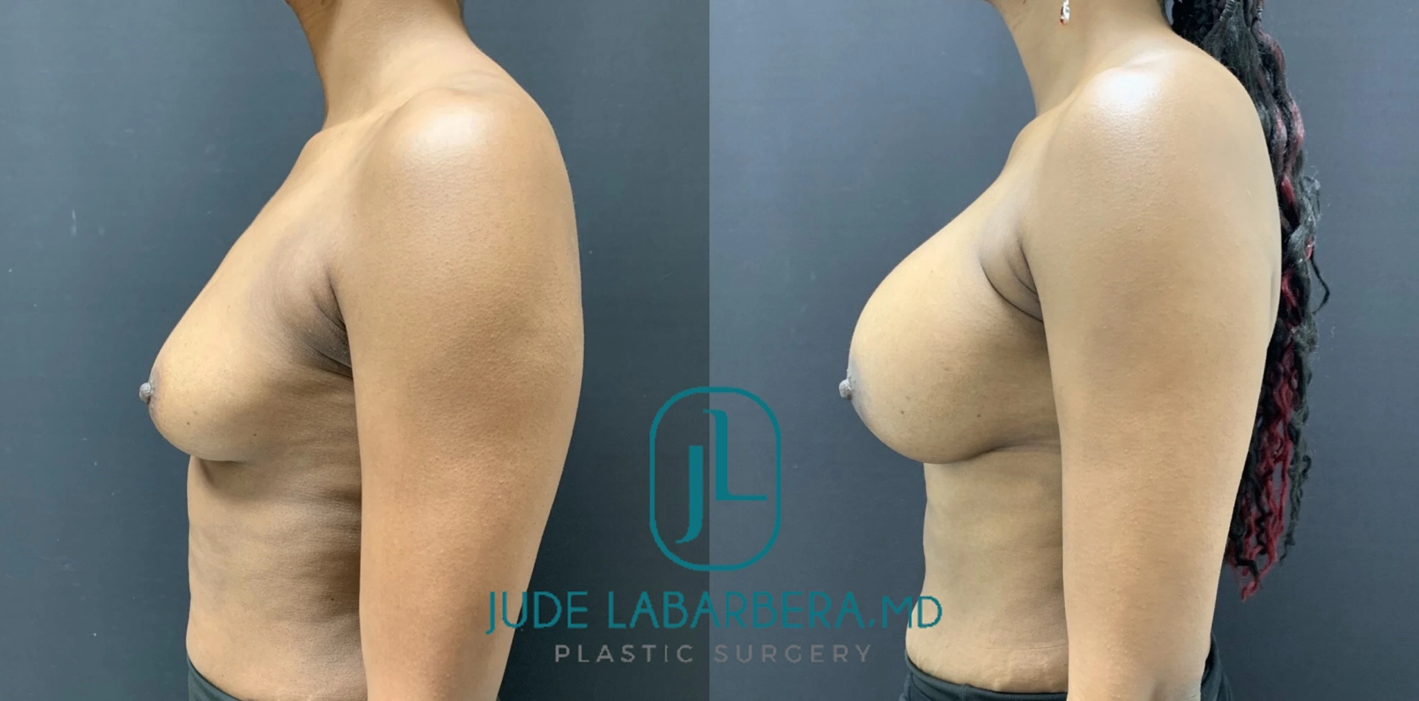 eZy Watermark_25-10-2024_12-58-46-2420PM