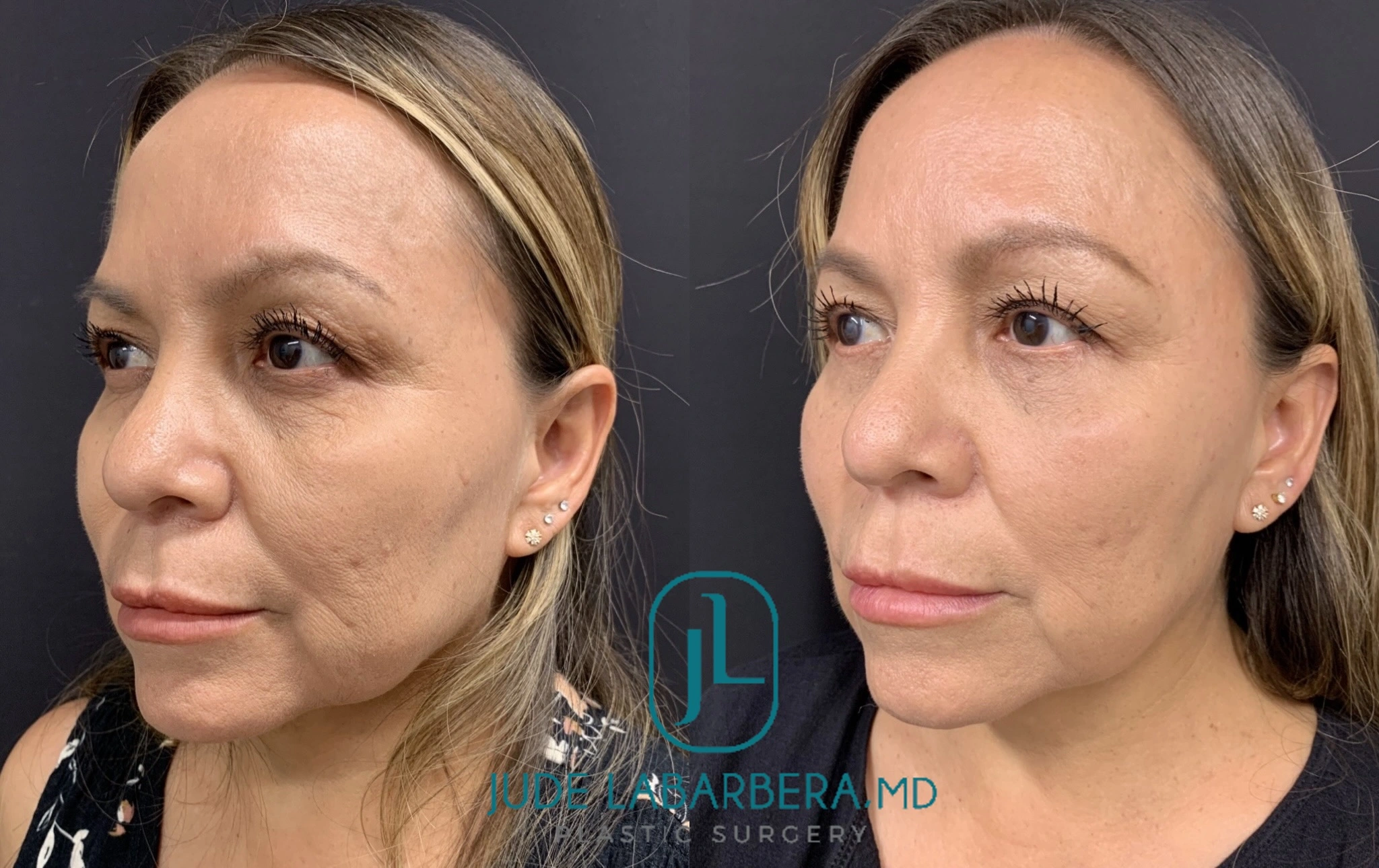 eZy Watermark_30-08-2024_08-20-55-9070AM