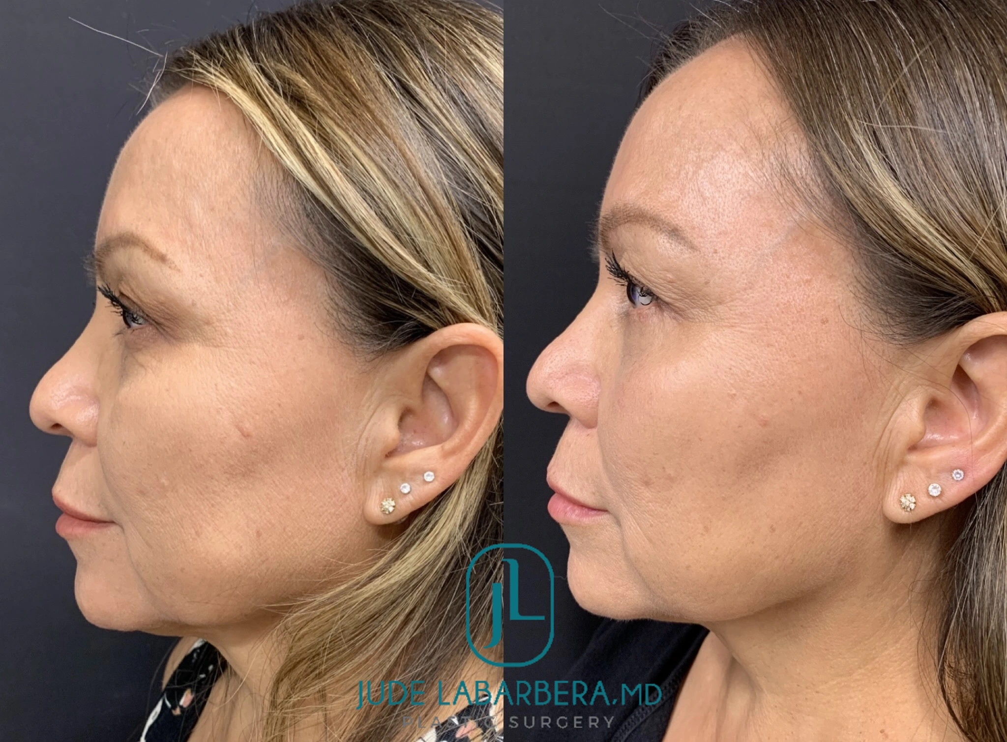 eZy Watermark_30-08-2024_08-21-09-5210AM