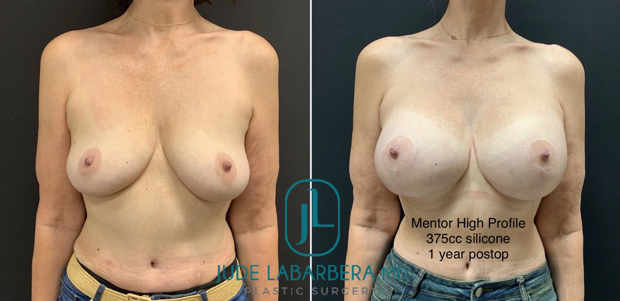 eZy Watermark_31-01-2024_09-32-47-6760AM